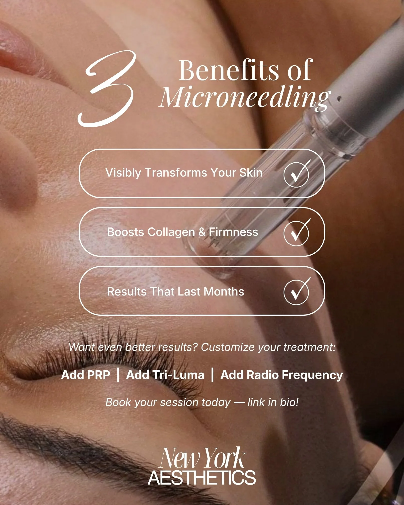 Microneedling is one of those treatments that earns its reputation the honest way. It works with your skin, not against it, prompting your own collagen to rebuild from the inside out.

A few things our clients notice:
✔️ Visibly smoother, more even t