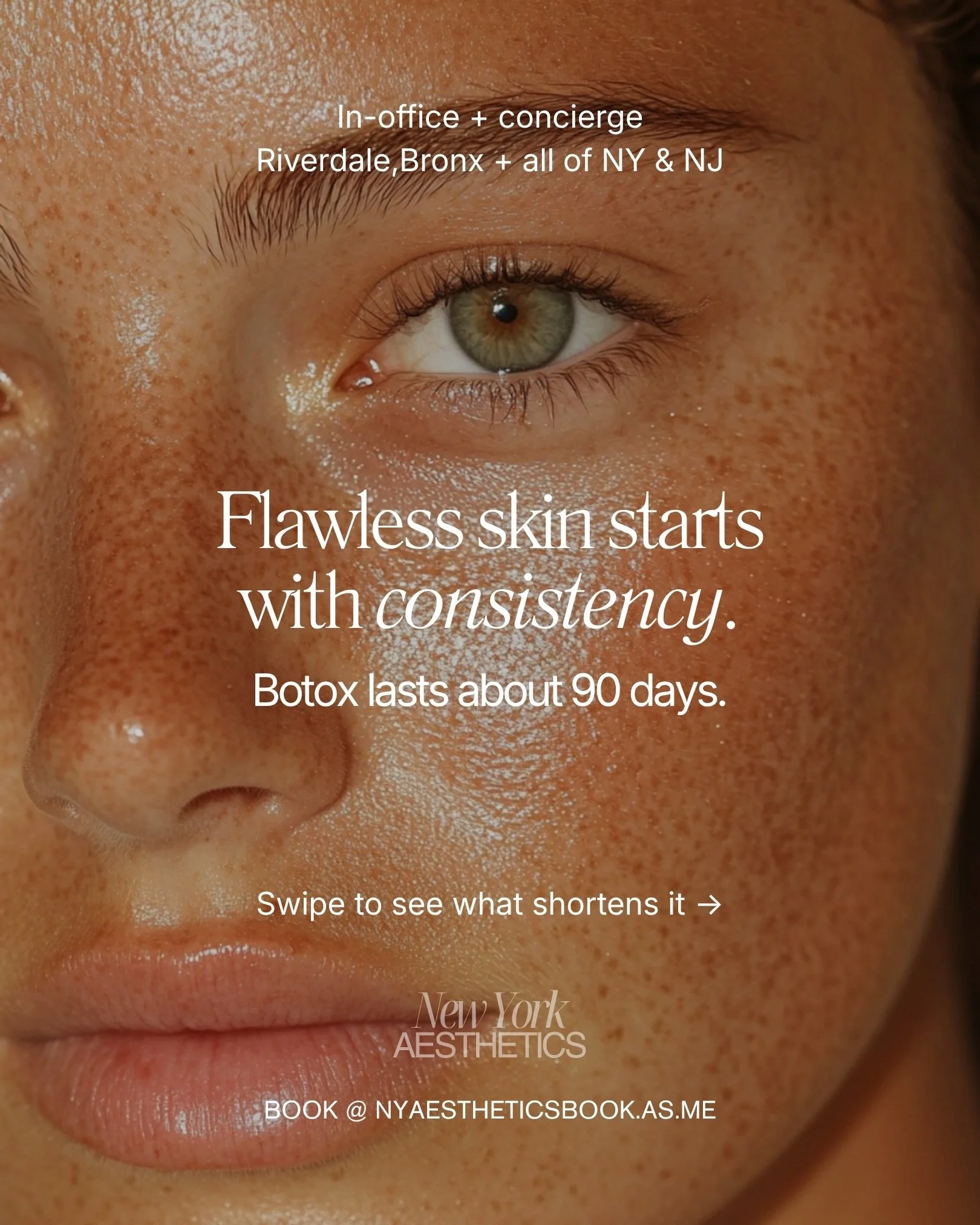 How long does Botox last? For most clients, about 90 days. However, your lifestyle can shorten that window more than you might expect.

Botox works by relaxing the muscles that create expression lines, and your body gradually breaks it down over time