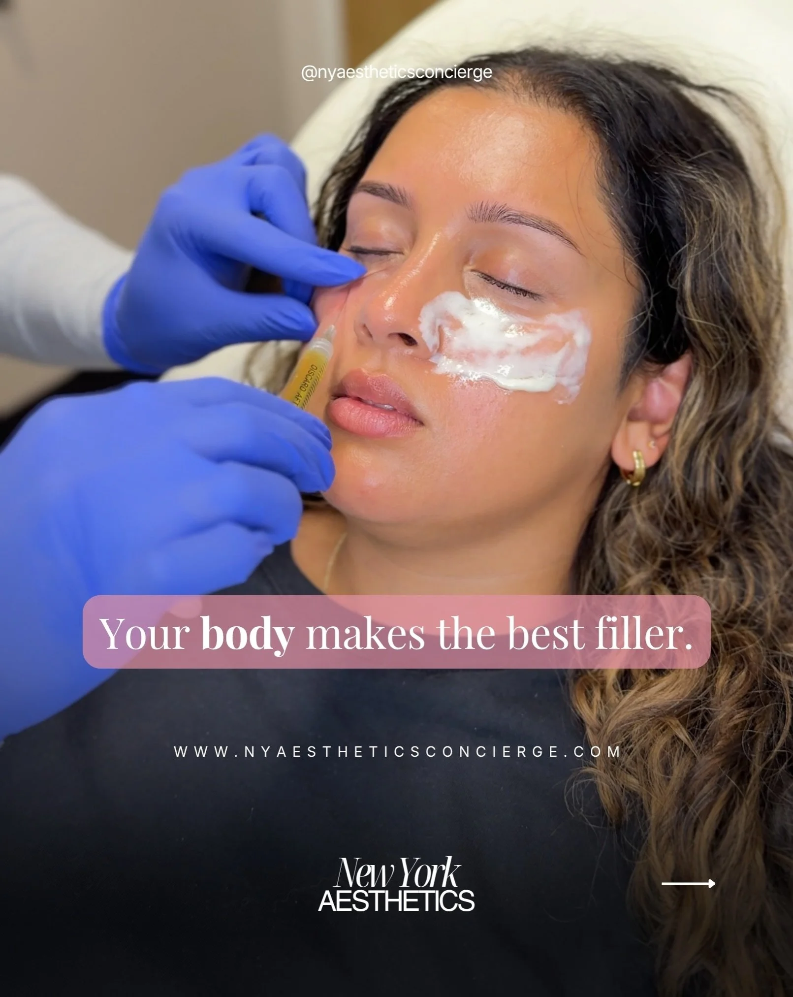 Results typically last four to six months and continue to improve as your collagen rebuilds. For the best outcome, we recommend two to three sessions spaced six weeks apart.

What makes the experience different here is simple: you are not a name on a