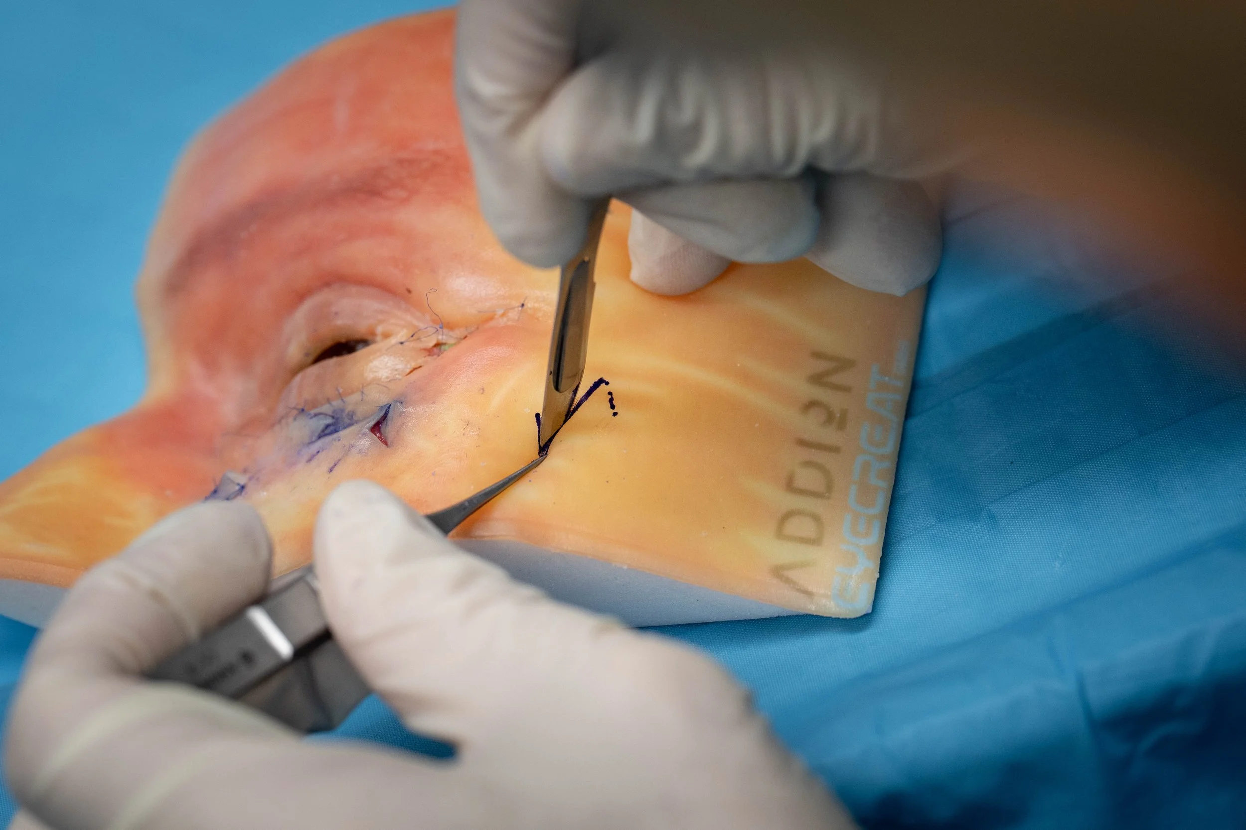 The SeThe Second Lid & Keratoplastic SUMMIT Tirol 2025