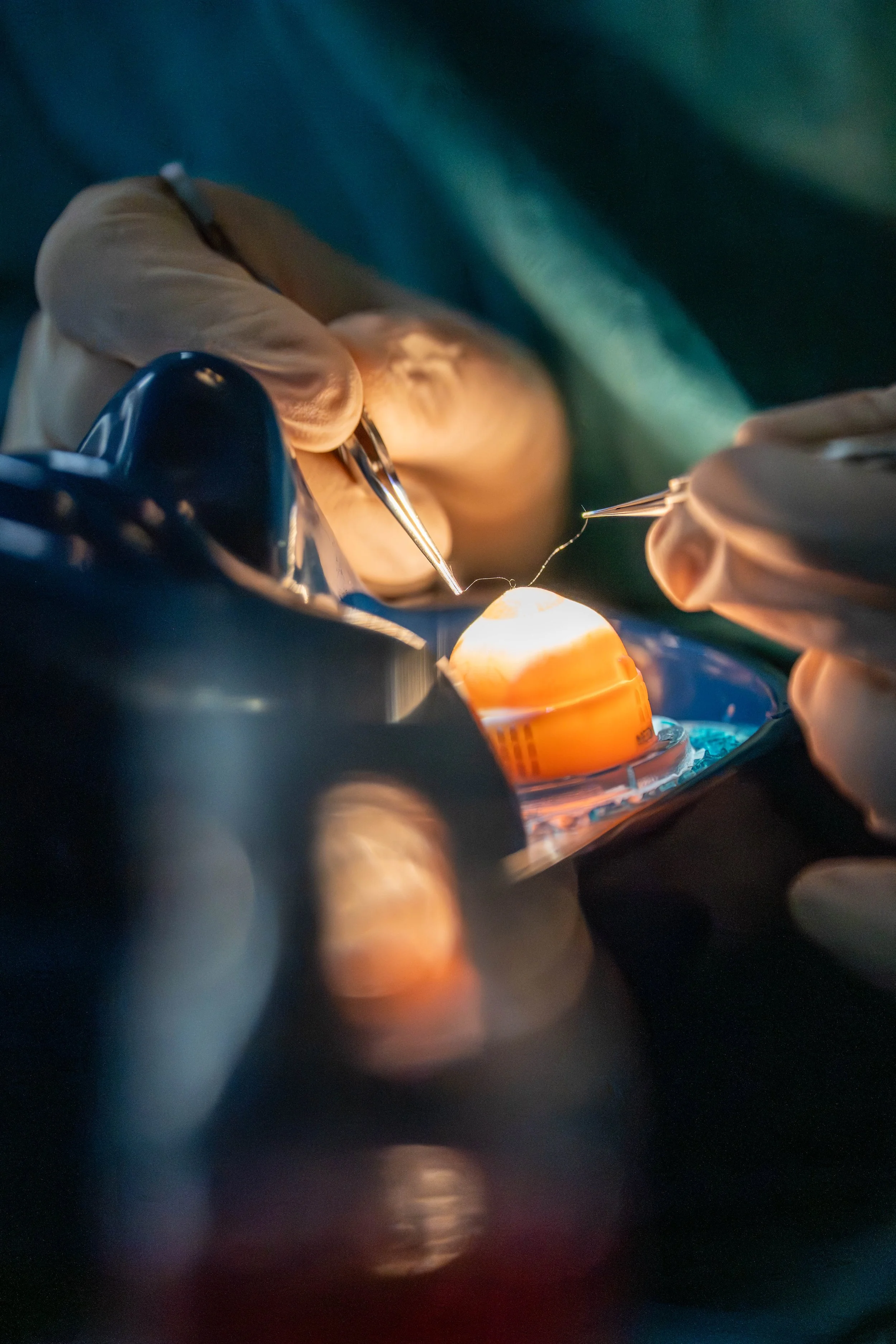 The SeThe Second Lid & Keratoplastic SUMMIT Tirol 2025