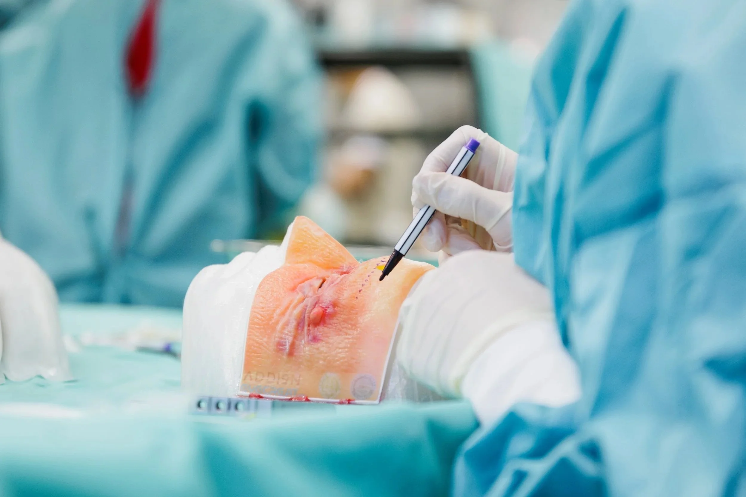 Medical professionals performing a procedure with a realistic eyelid model