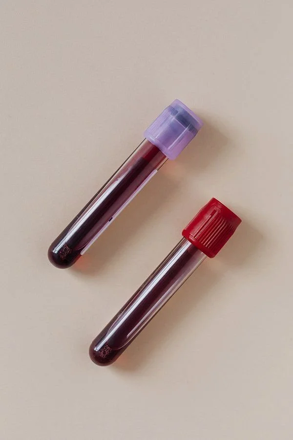 Two blood sample collection tubes with purple and red caps on a beige surface.