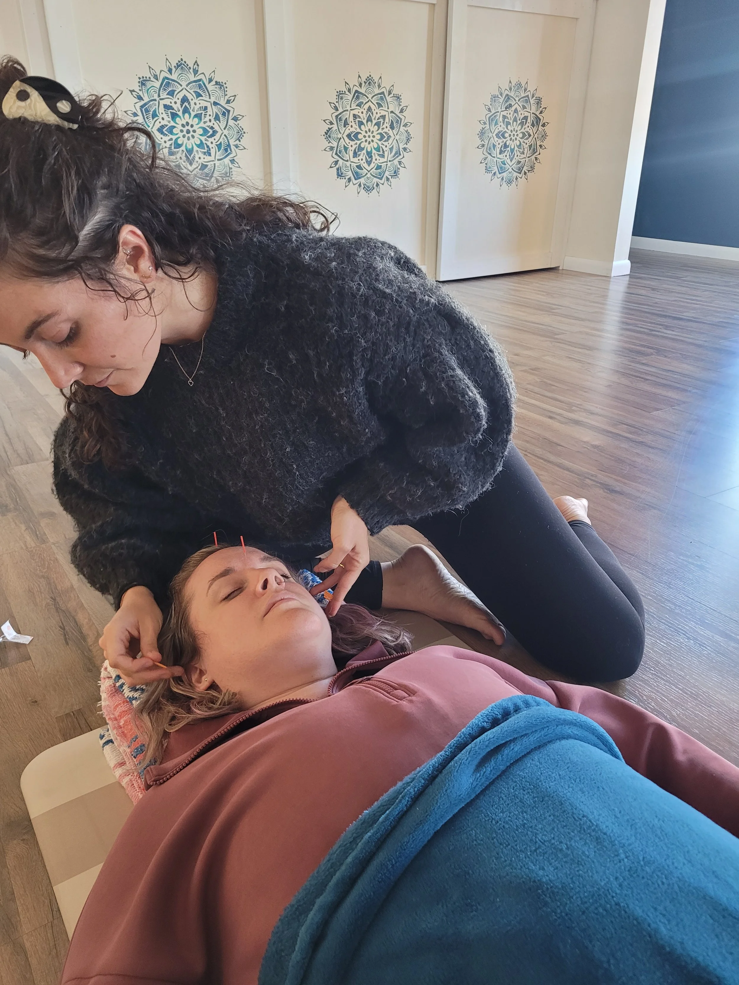 Yoga and Acupuncture 