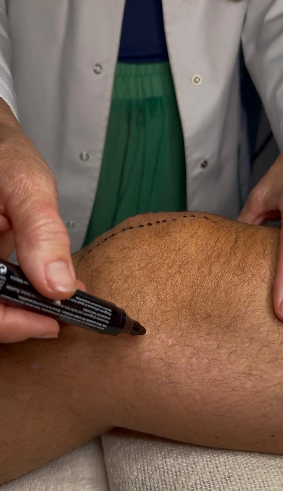 Rehabilitación fisica