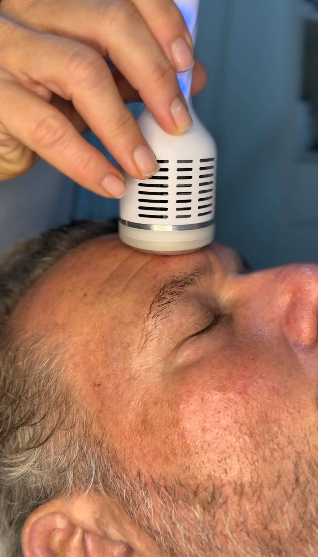 Un hombre recibe un tratamiento facial con un dispositivo médico en la frente, realizado por una persona con manos visibles.