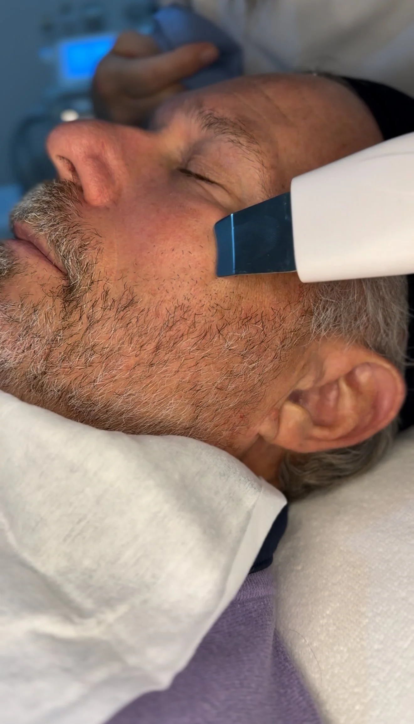 Hombre mayor durmiendo con un equipo médico en la cabeza, probablemente en un proceso de evaluación médica o tratamiento.