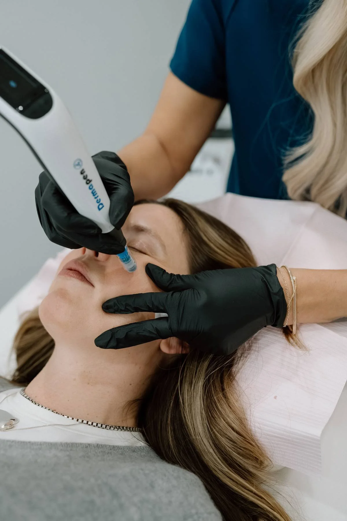 female lying in clinic chair while having micro needling procedure, hands with black gloves administering treatment, female patient appears calm with eyes closed