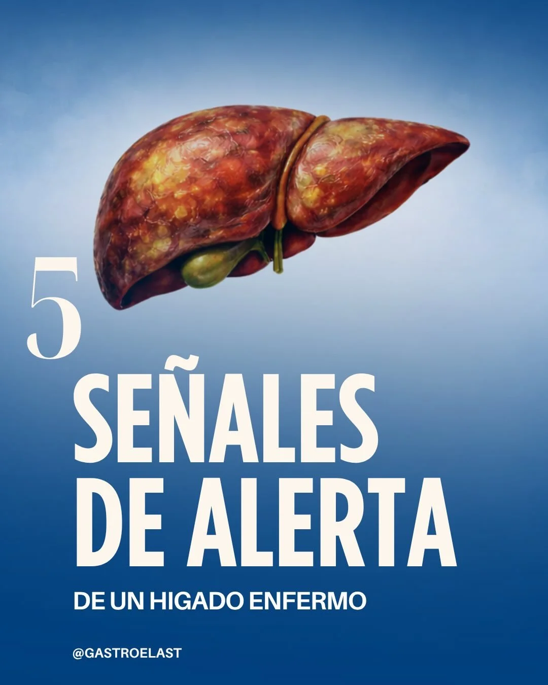 El h&iacute;gado no siempre da se&ntilde;ales claras&hellip; pero cuando lo hace, es importante escuchar ⚠️

Ac&aacute; te mostramos 5 se&ntilde;ales que podr&iacute;an indicar que algo no est&aacute; funcionando bien. Detectarlos a tiempo puede hace