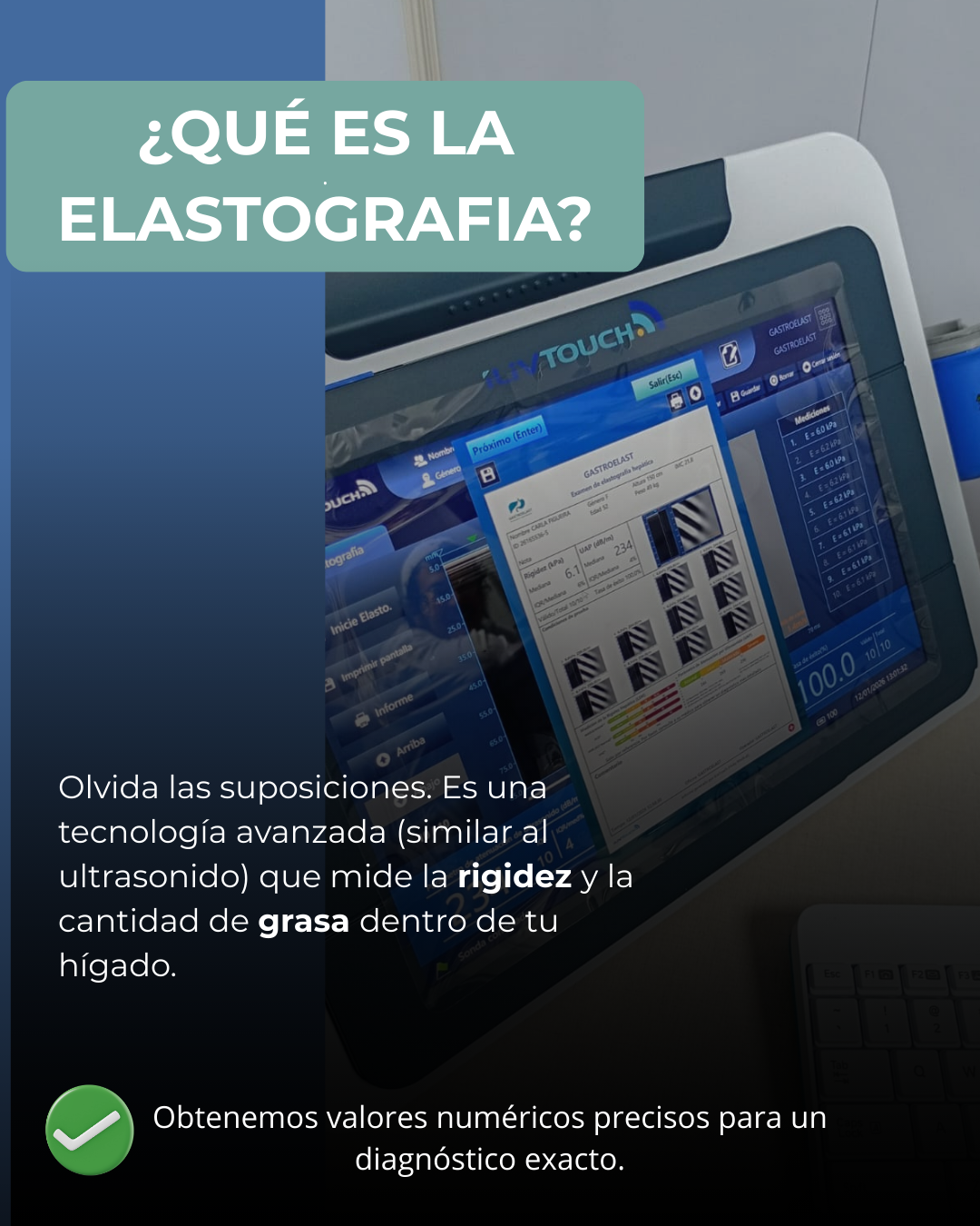 Pantalla de un equipo de elastografía que muestra resultados y gráficos relacionados con la medición de rigidez y grasa en el hígado.