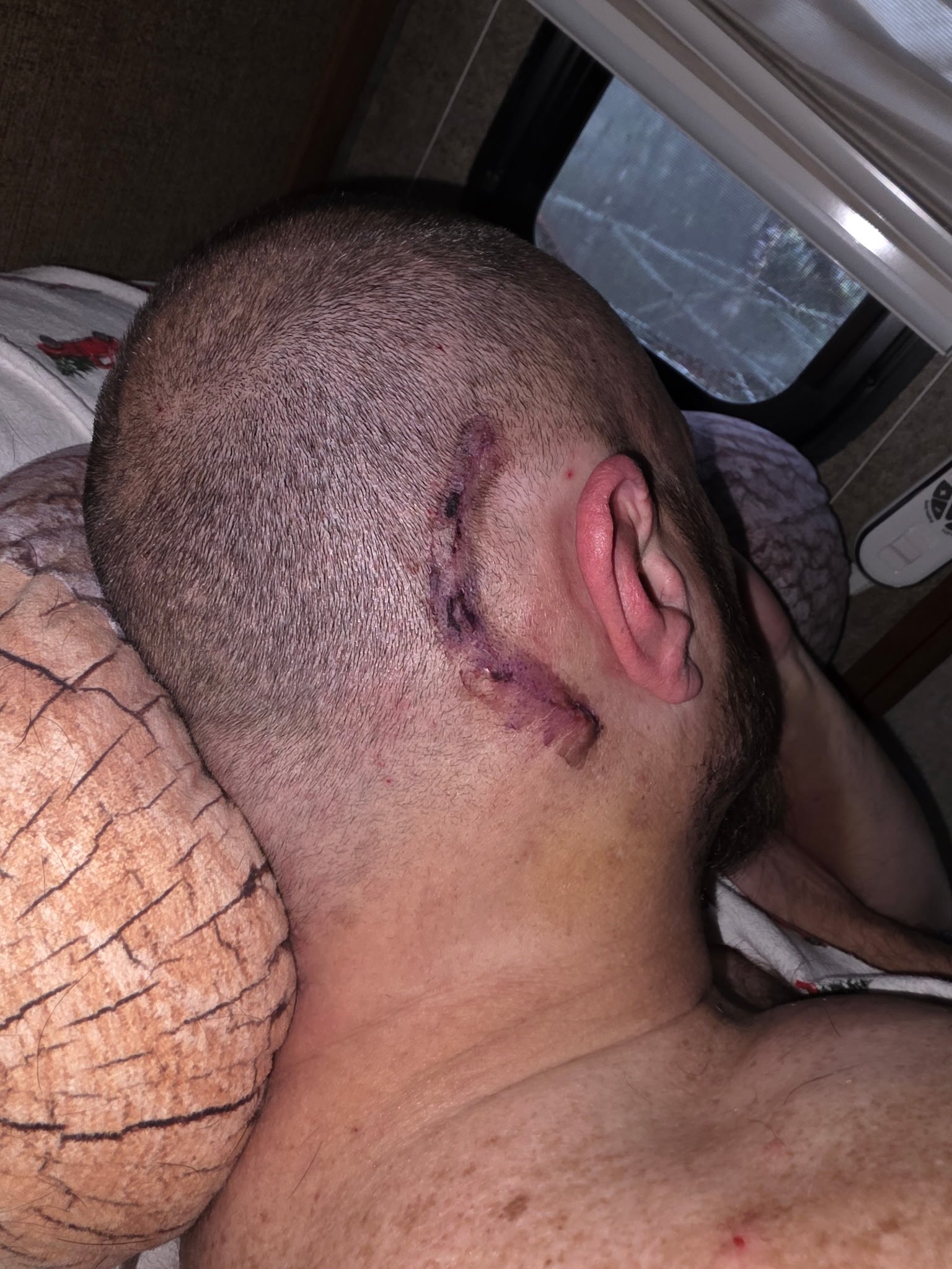 Mental Clarity: Riding Through Pain and Survival