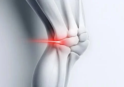 Medical illustration of a human knee with a red area indicating pain or injury.