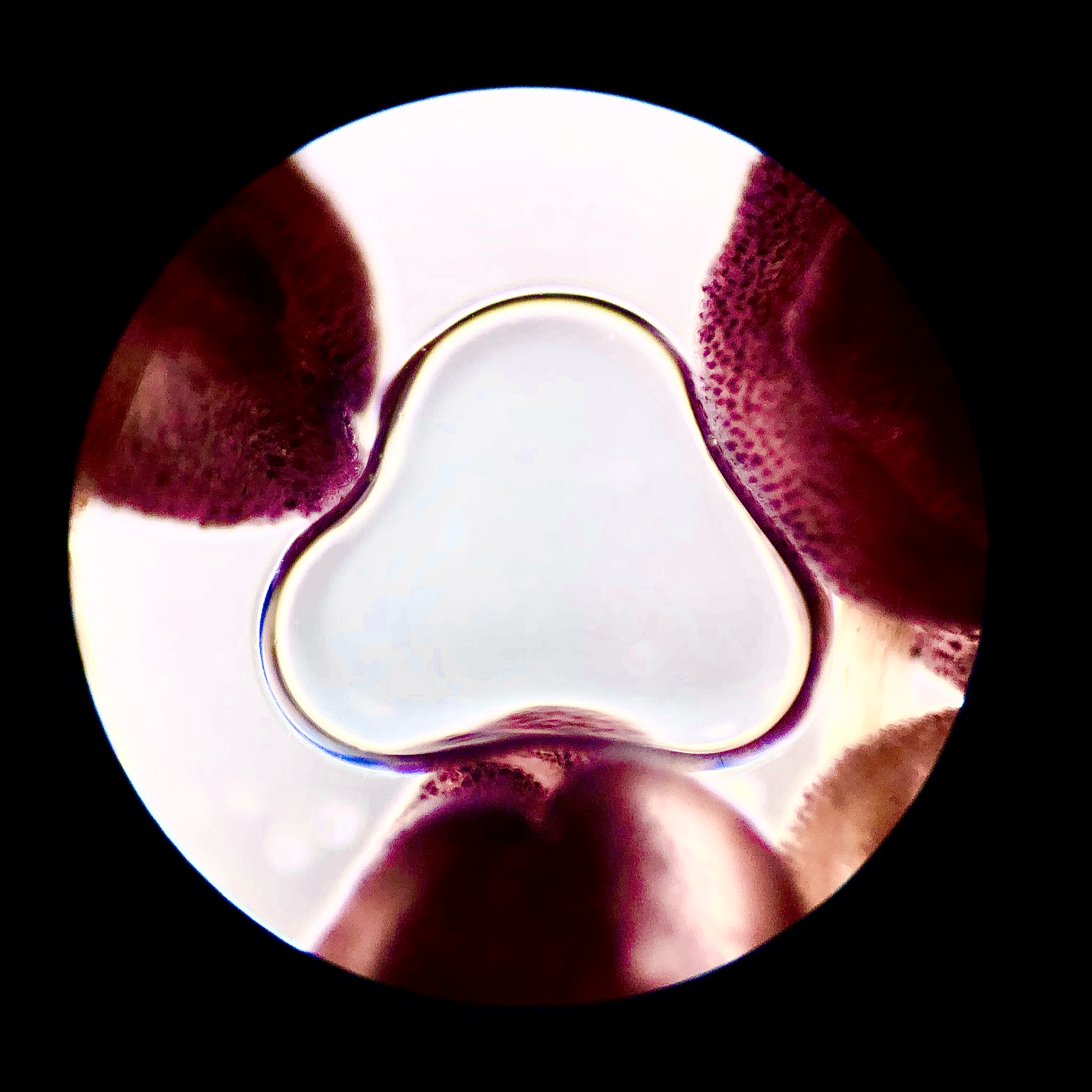 Cherry blossom anther with air bubble; 10x objective