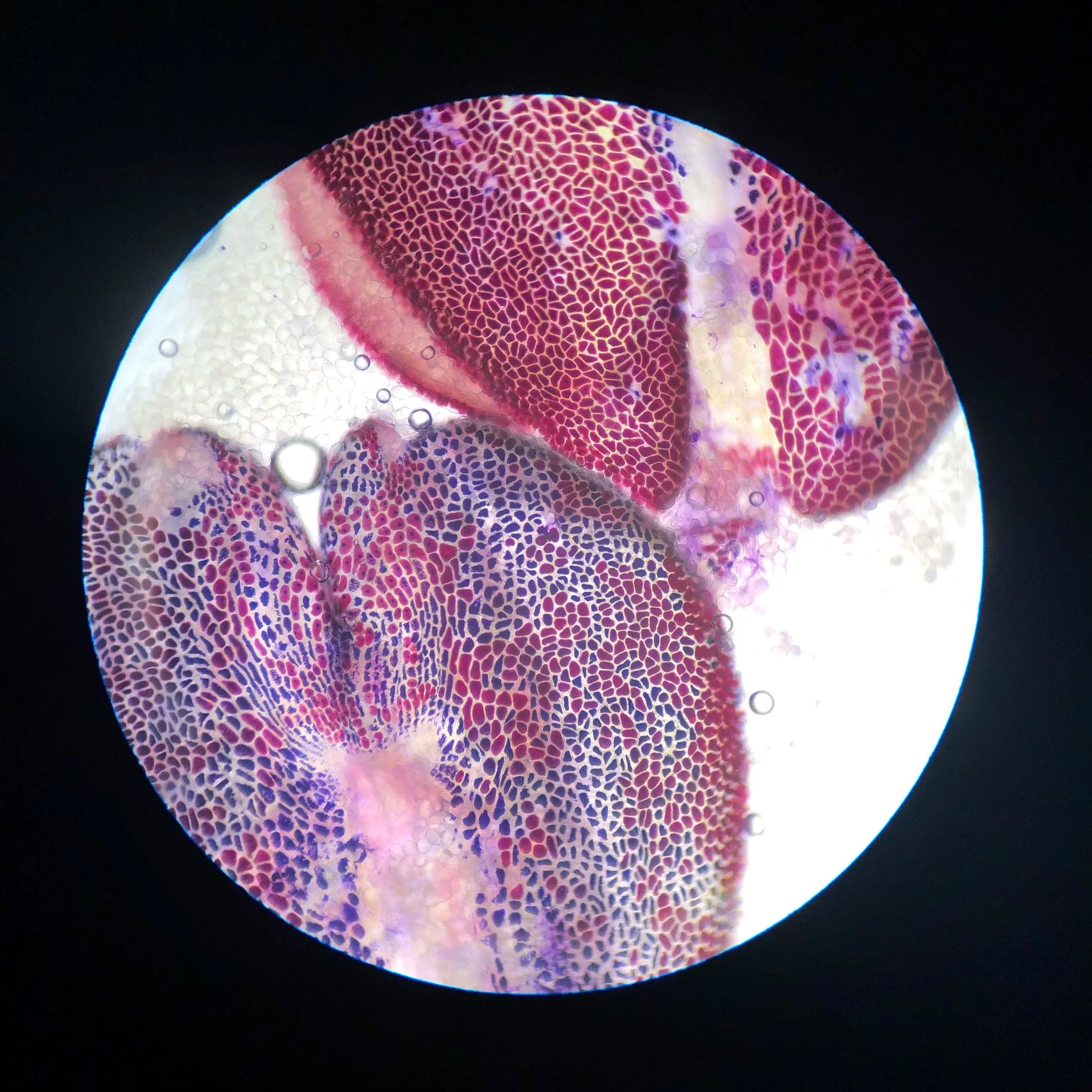 Pomegranate seeds; 10x objective