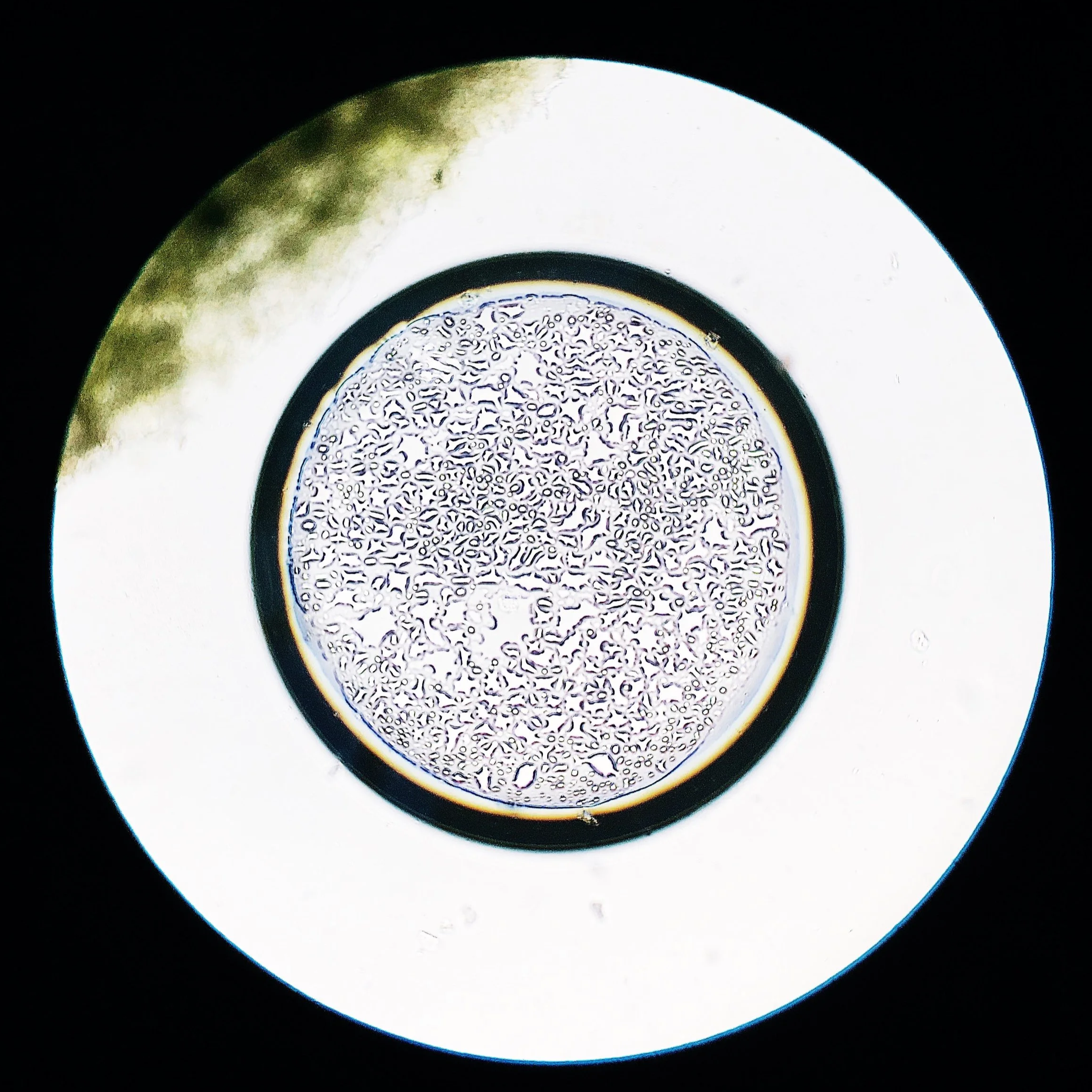 Air bubble; x4 objective  