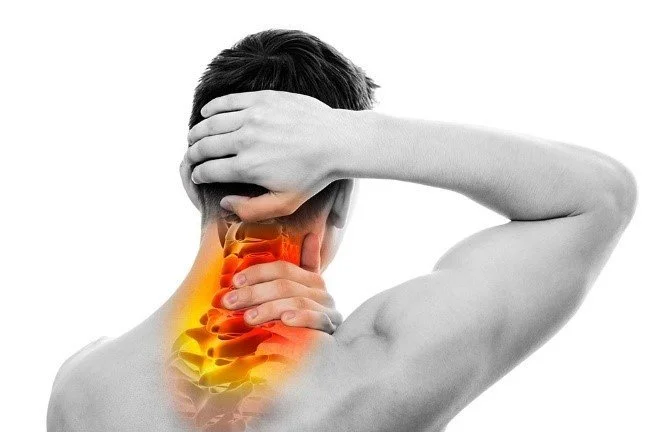 The Extreme Pain of Wry Neck