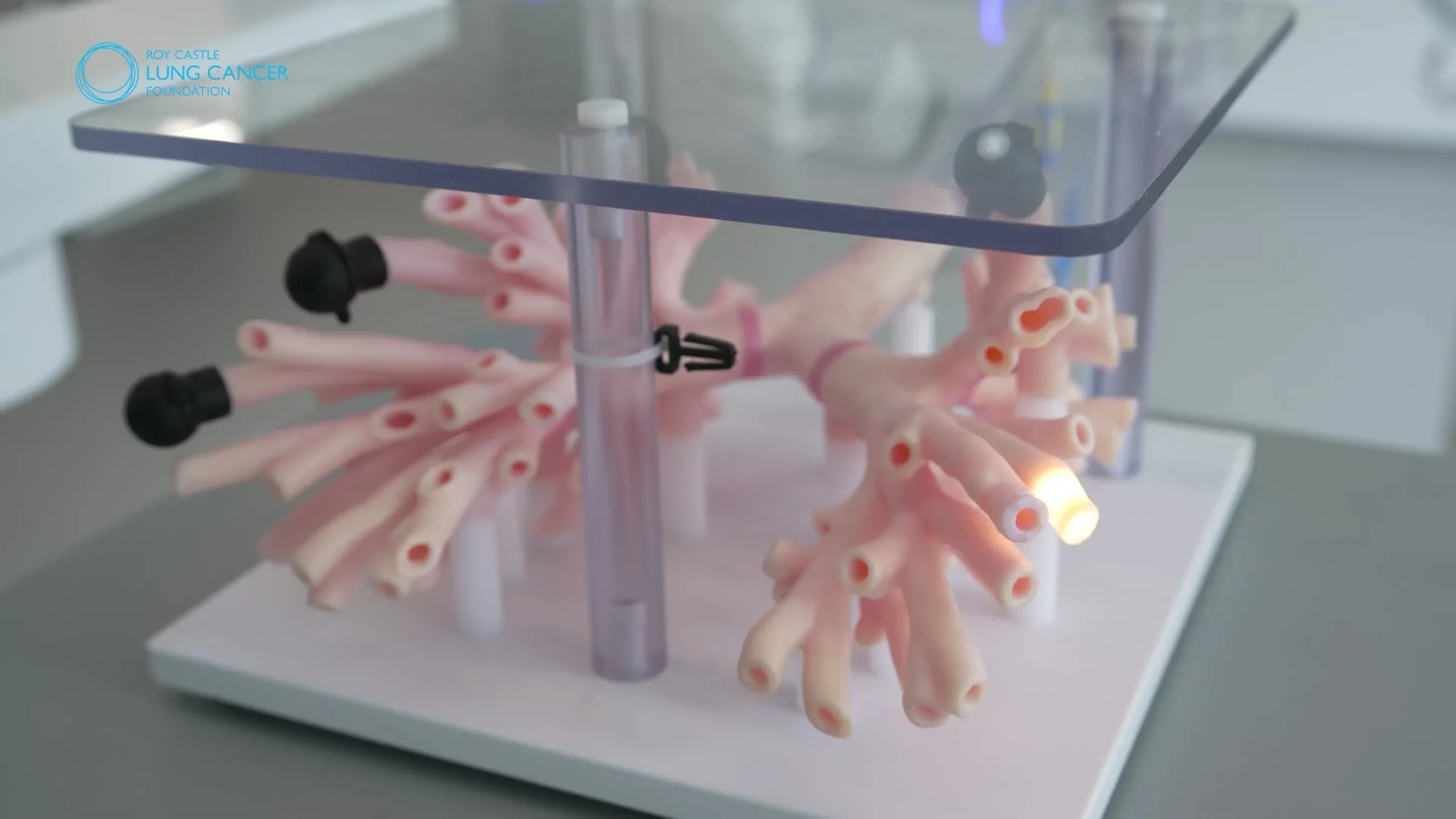 roy-castle-lung-cancer-foundation-robotic-bronchoscopy-medical-video-lung-airway-model.jpg