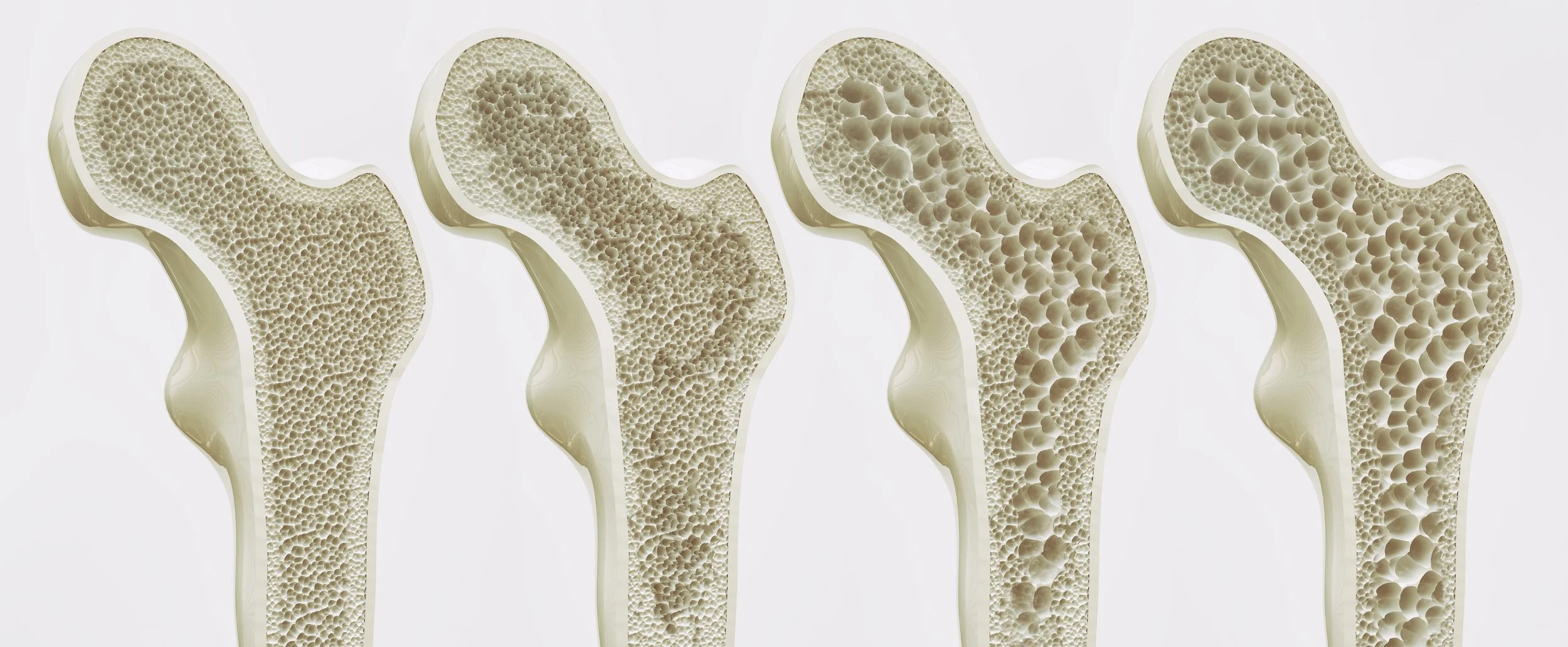 Bone Density