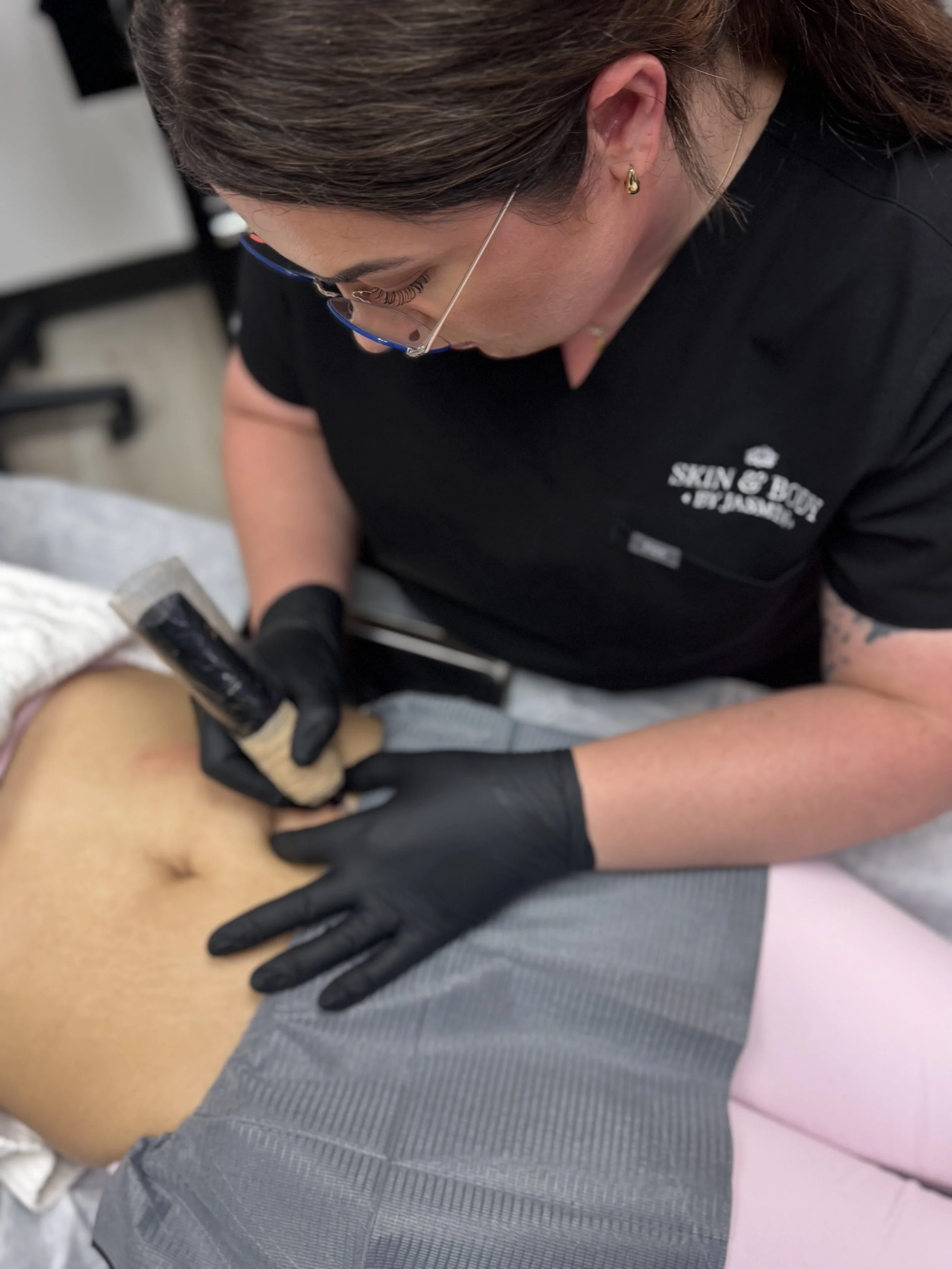 A professional applying a tattoo to a person's stomach using a tattoo machine.