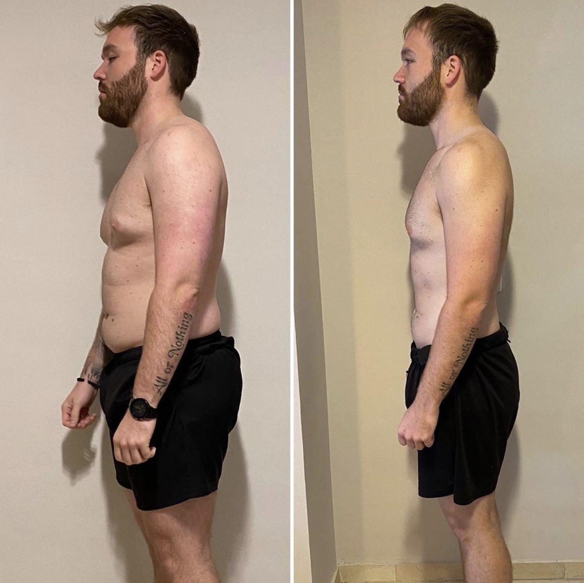 GLP-1 weight loss Morgantown WV