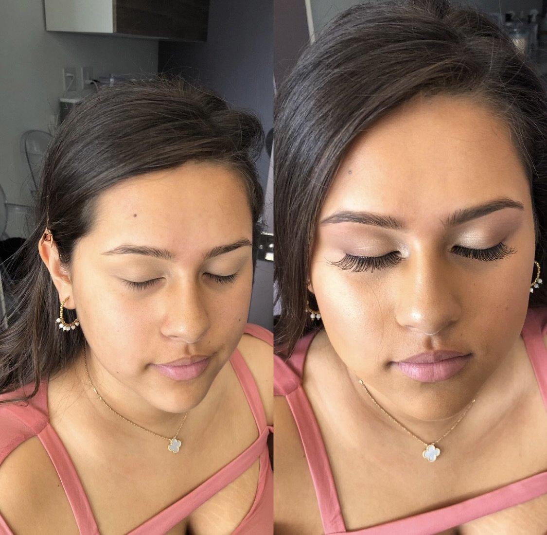 Comparison of a woman's face before and after skincare treatment, showing reduced skin redness, smoother complexion, and fewer visible freckles.