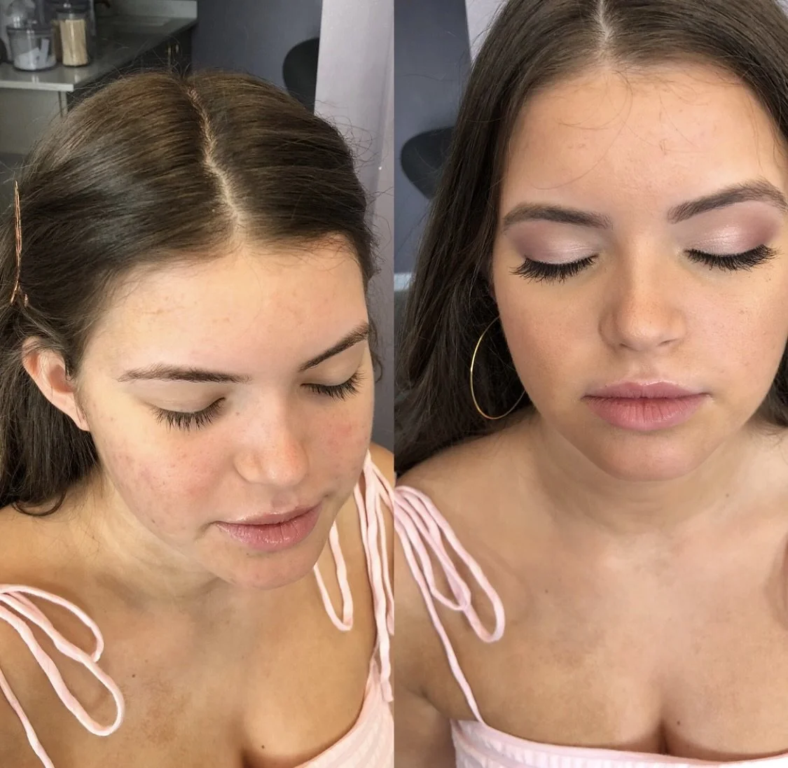 Side-by-side comparison of a woman’s face before and after skincare or cosmetic treatment, showing smoother, more even skin tone in the after image.