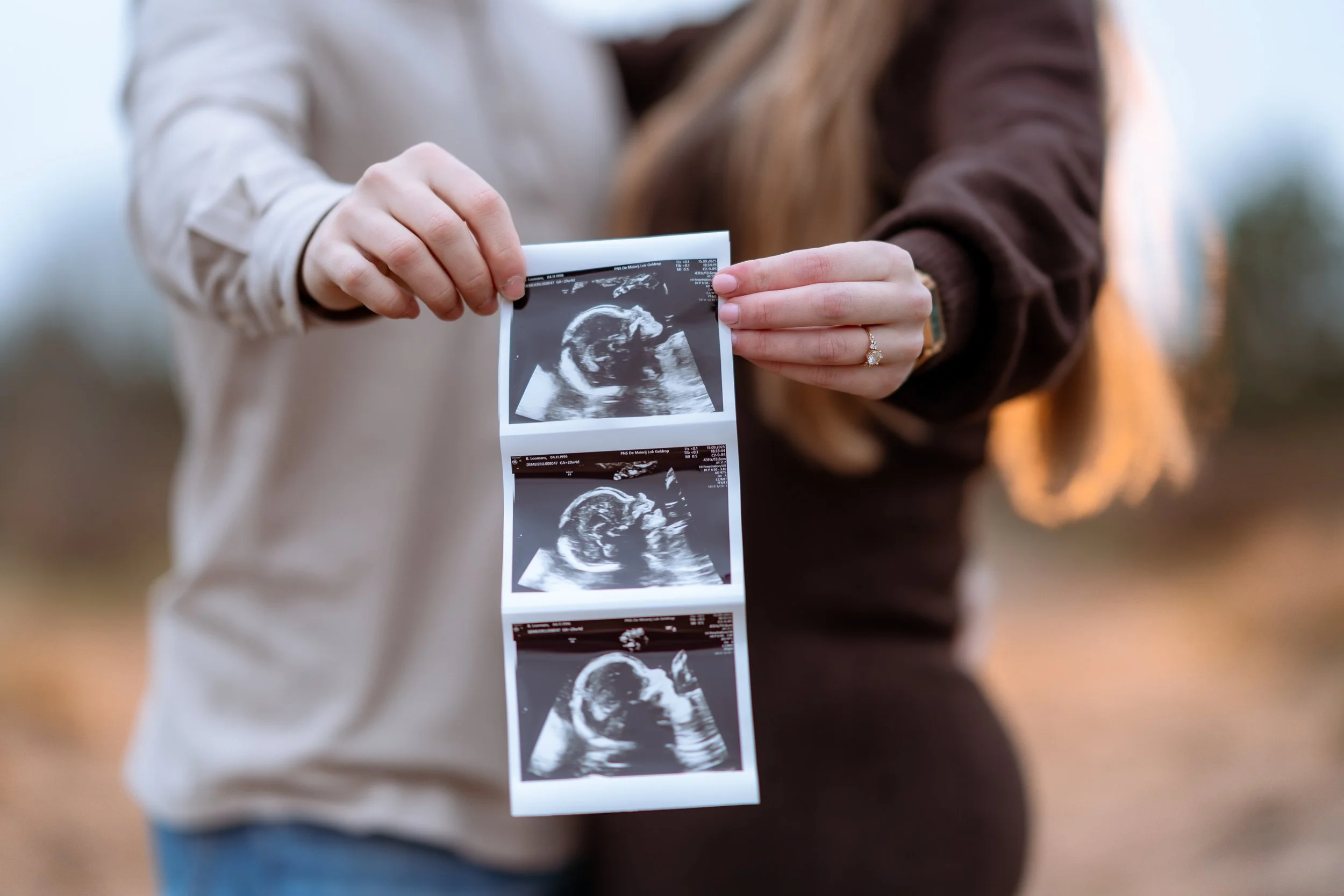 Person holding up three ultrasound images of a fetus outdoors with a woman in the background.