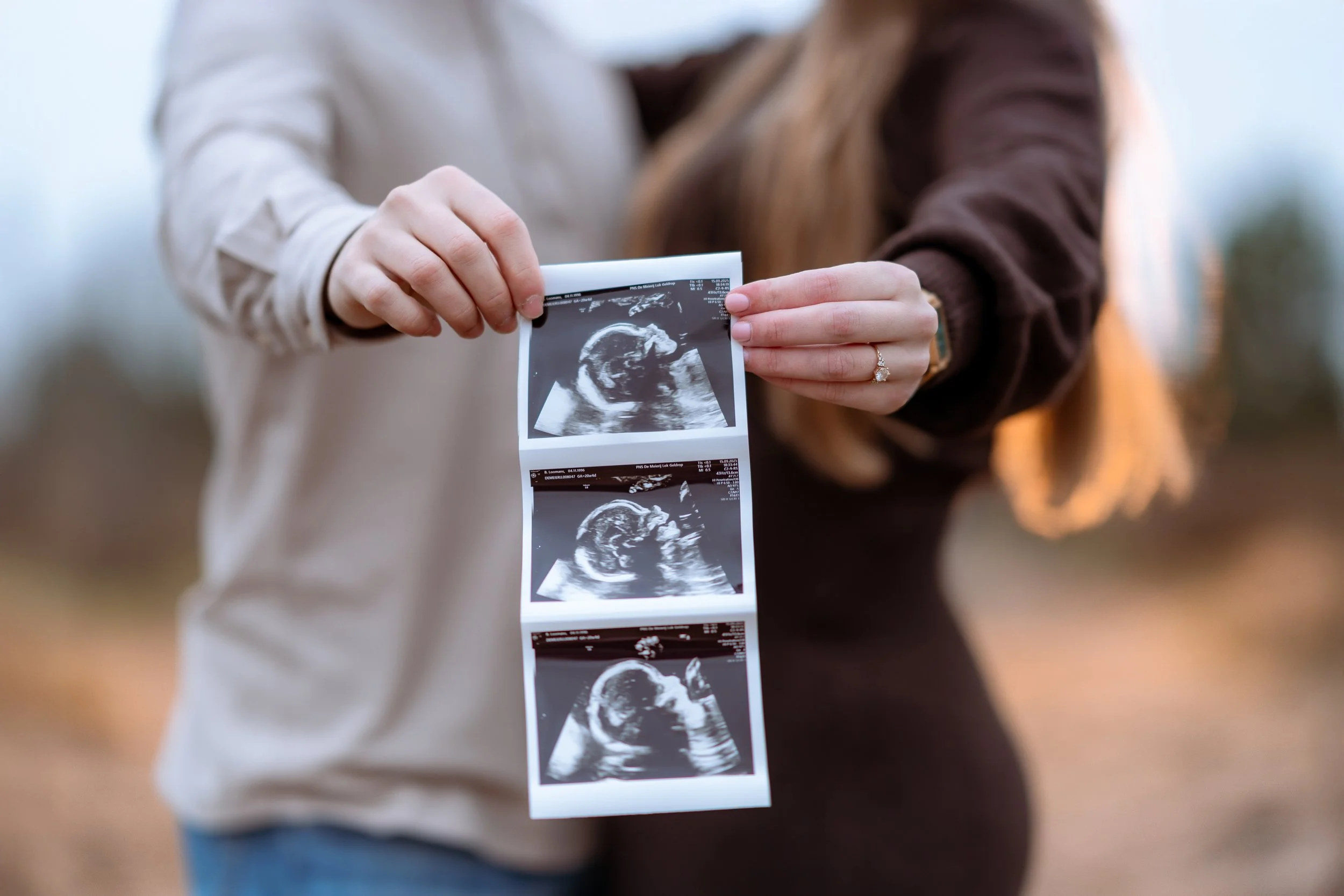Person holding three ultrasound images of a developing fetus.