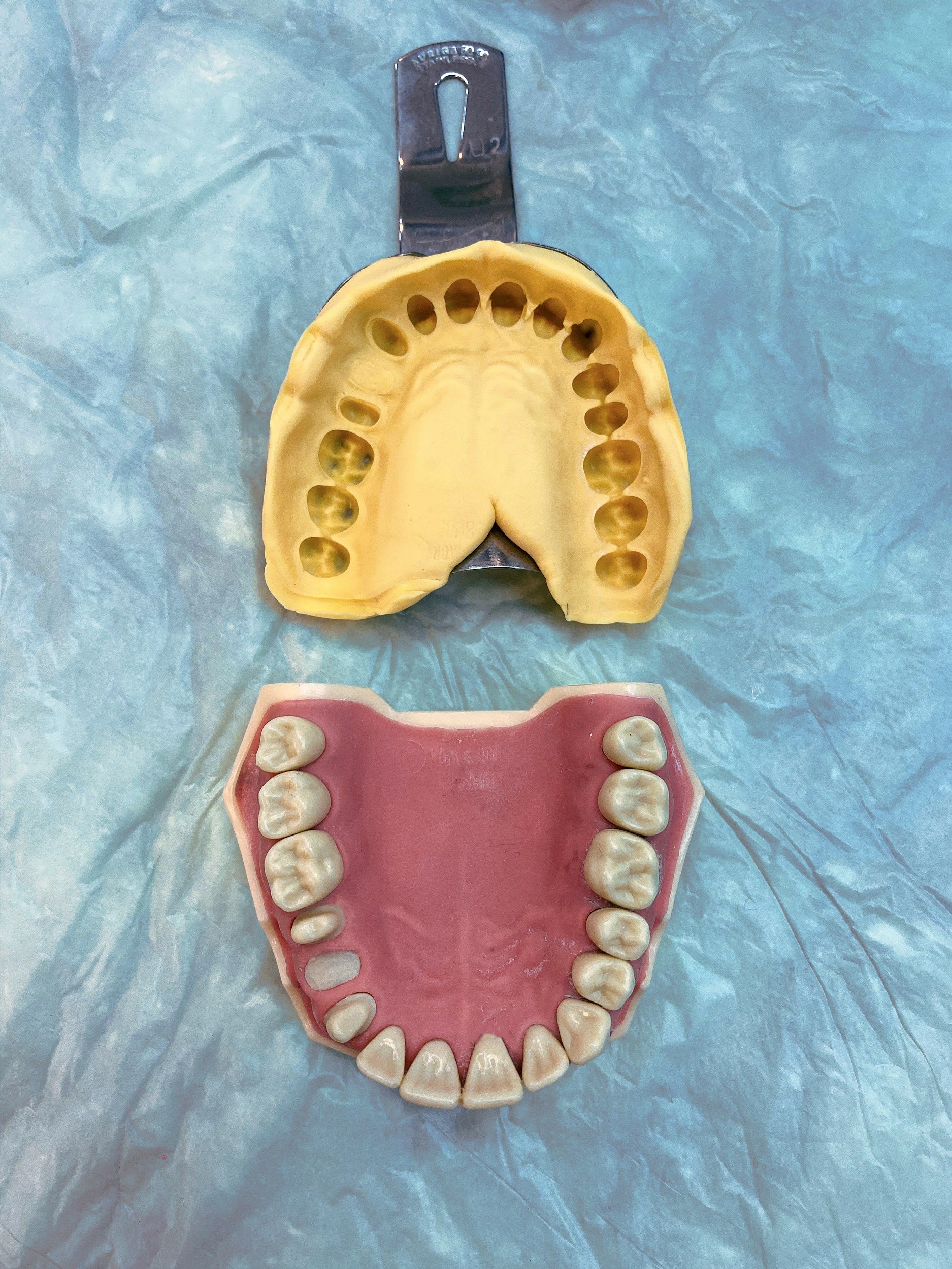 Black line drawing of an implant denture.