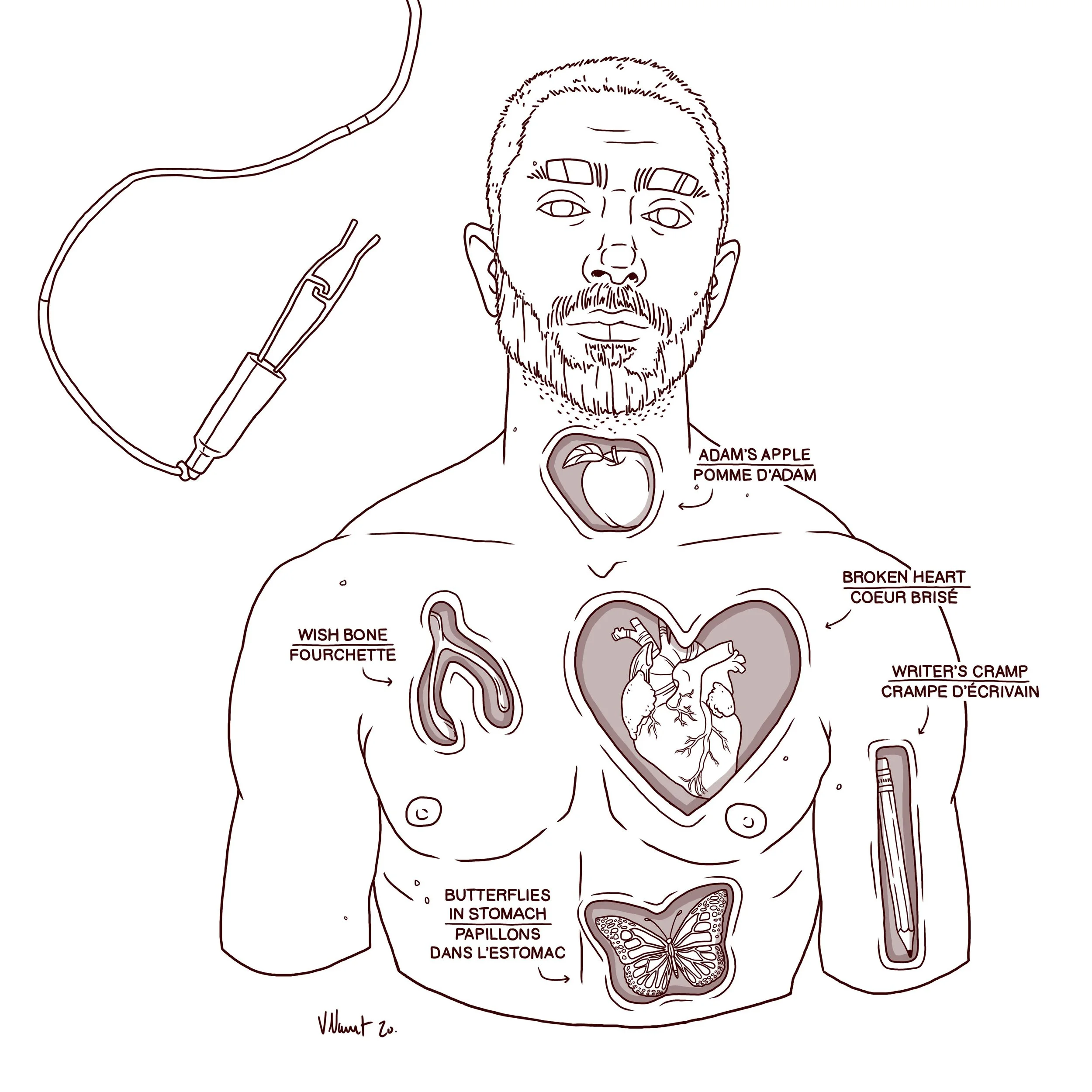 OPERATION1.jpg