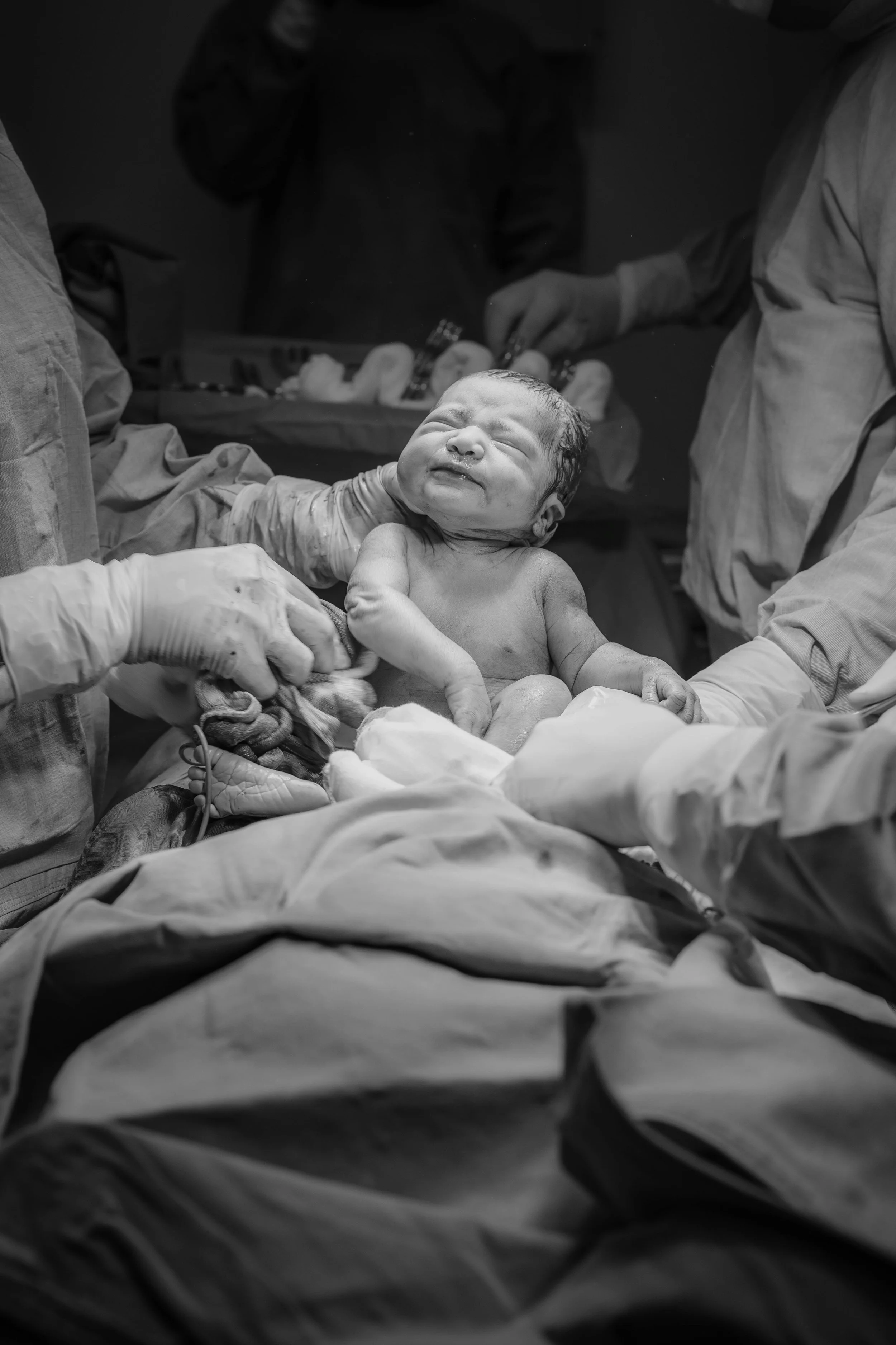 A newborn baby during delivery in a hospital operating room, surrounded by medical staff in scrubs and gloves.
