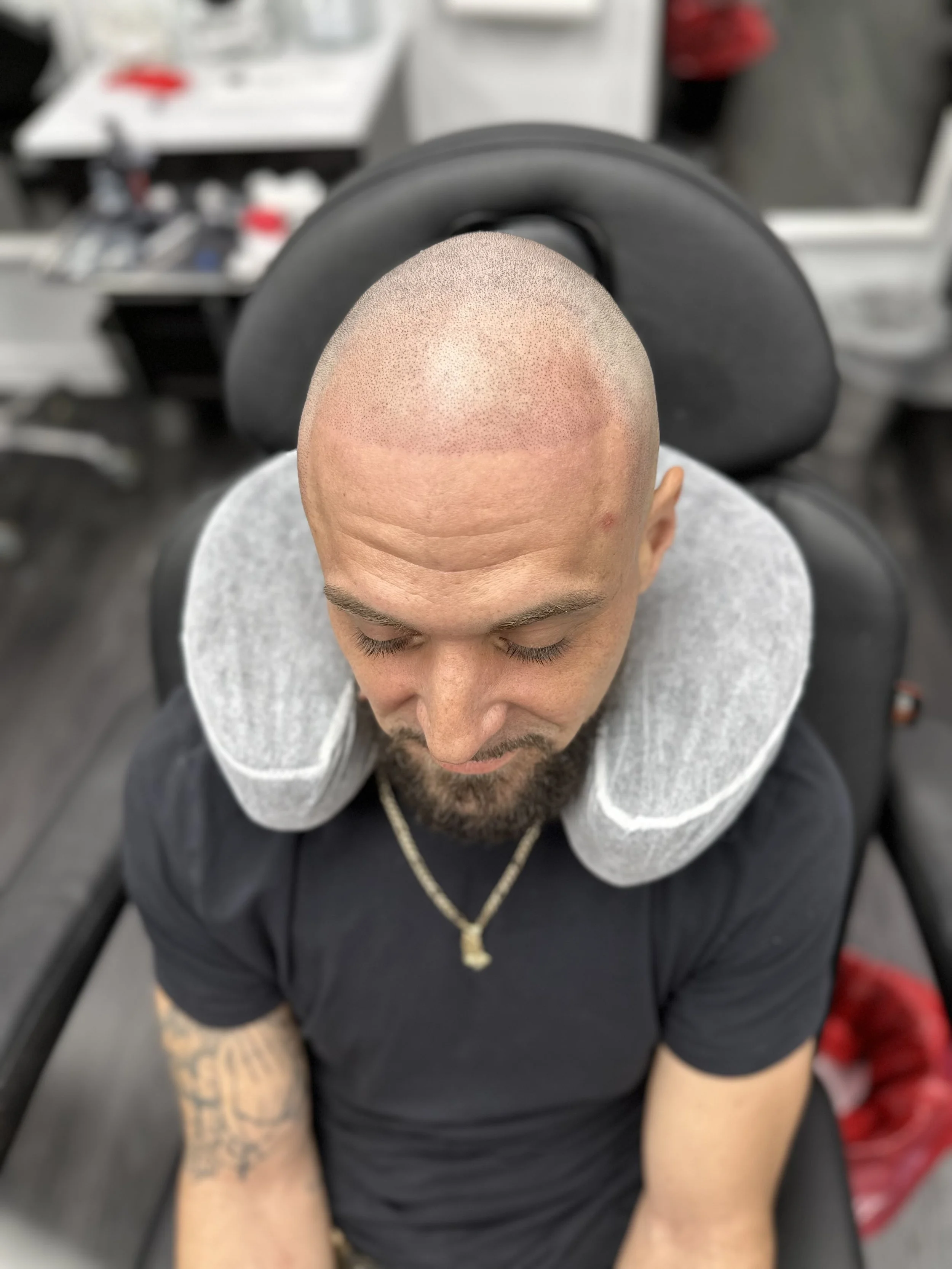 A man with a shaved head and beard sitting in a salon chair, getting a scalp micropigmentation tattoo, with a neck pillow for support.