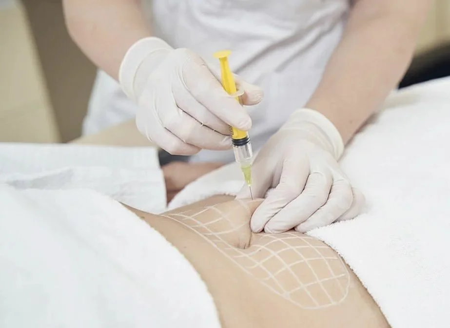 Profissional de saúde aplicando uma injeção na pele de um paciente, com marcações na pele para orientação.