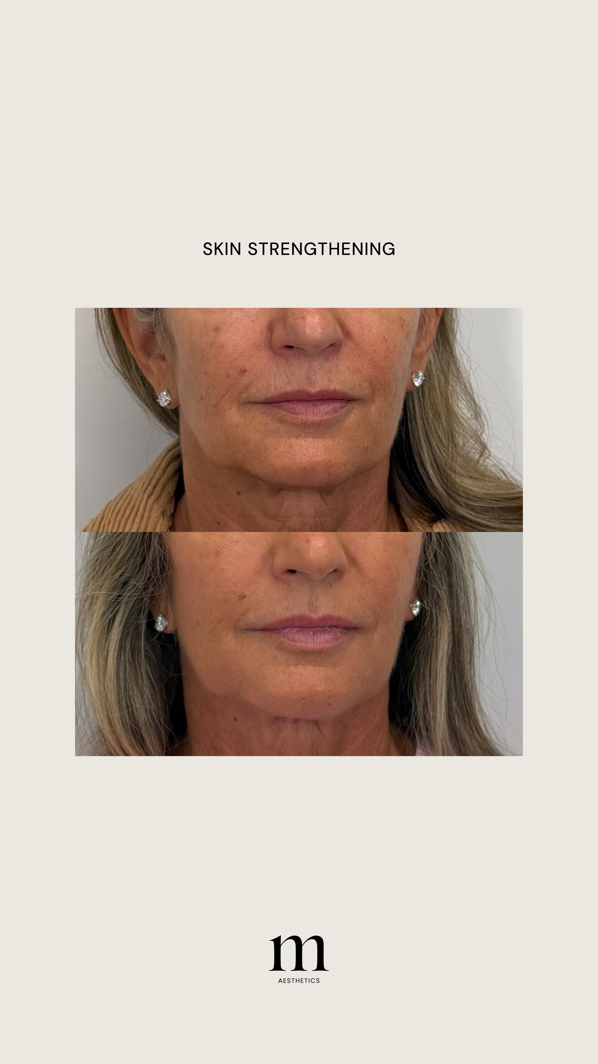 Before and after photos showing skin improvements in a woman with light skin, blonde hair, and earrings. The top image depicts her with visible sun damage, redness, and uneven skin tone, while the bottom image shows smoother, clearer skin after skin 