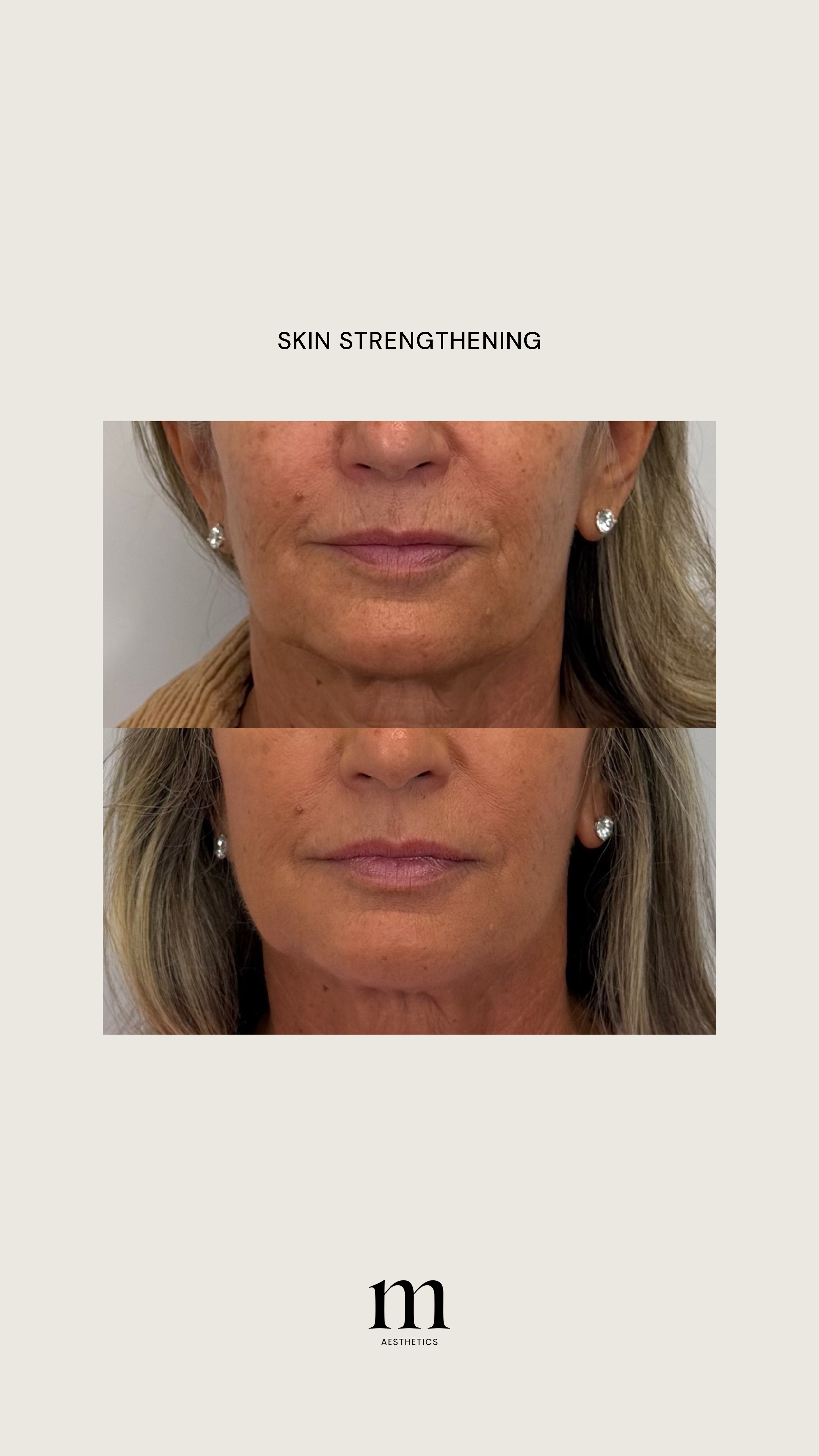 Before and after images of a woman's face showing skin with age spots and uneven tone in the before photo, and smoother skin with a more even tone in the after photo, highlighting skin strengthening results.