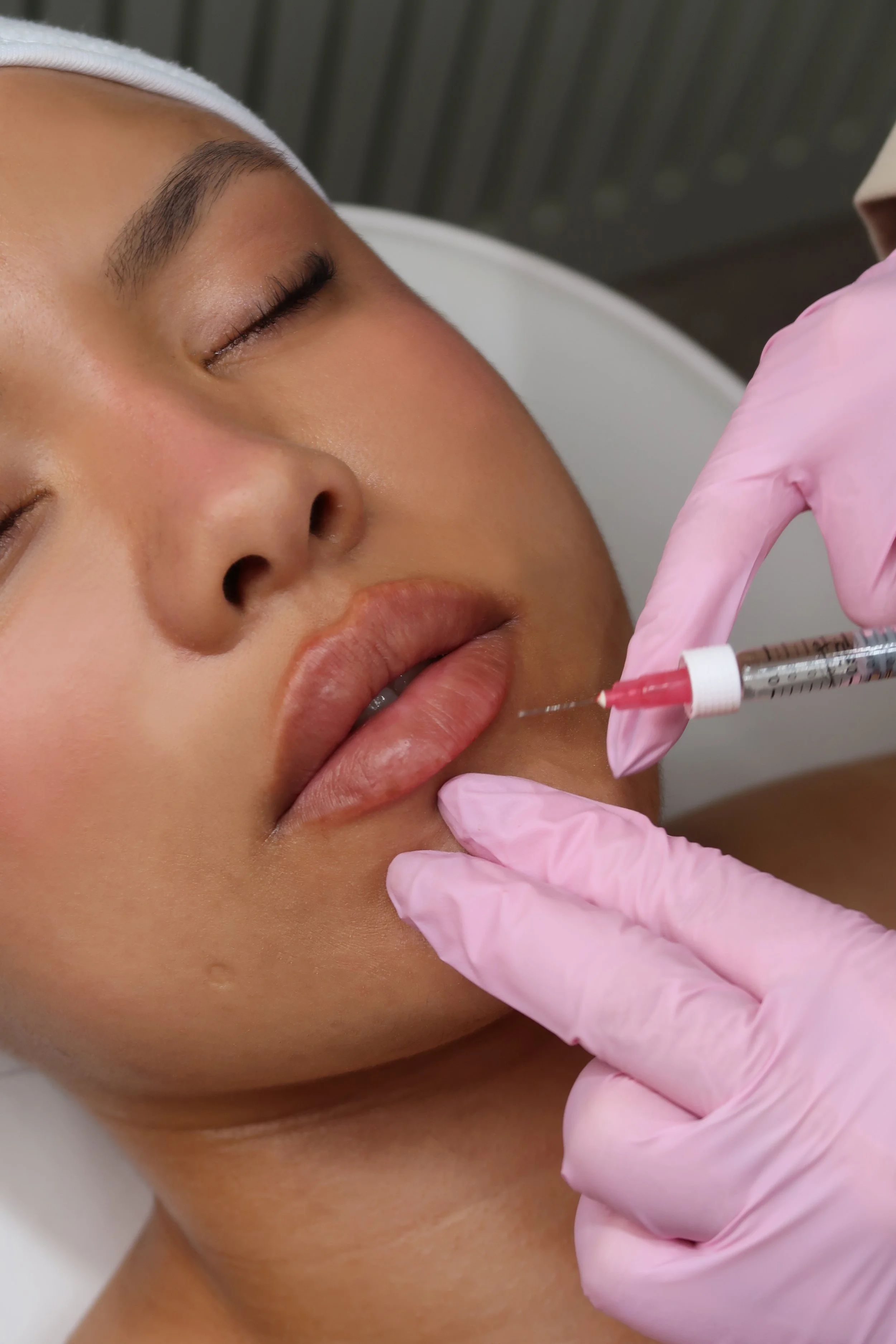 lip filler horsham West Sussex