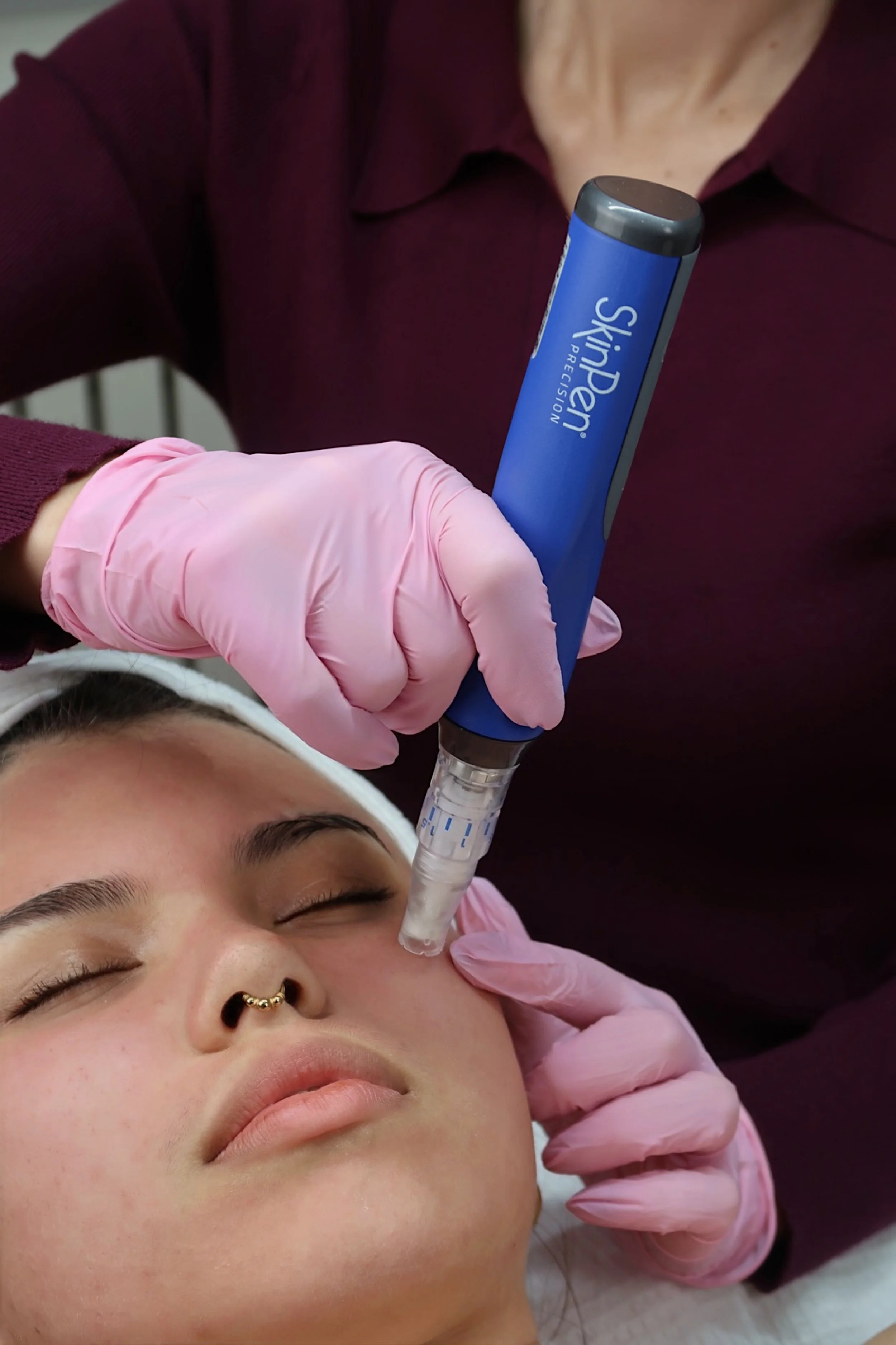 PRP microneedling SkinPen Horsham