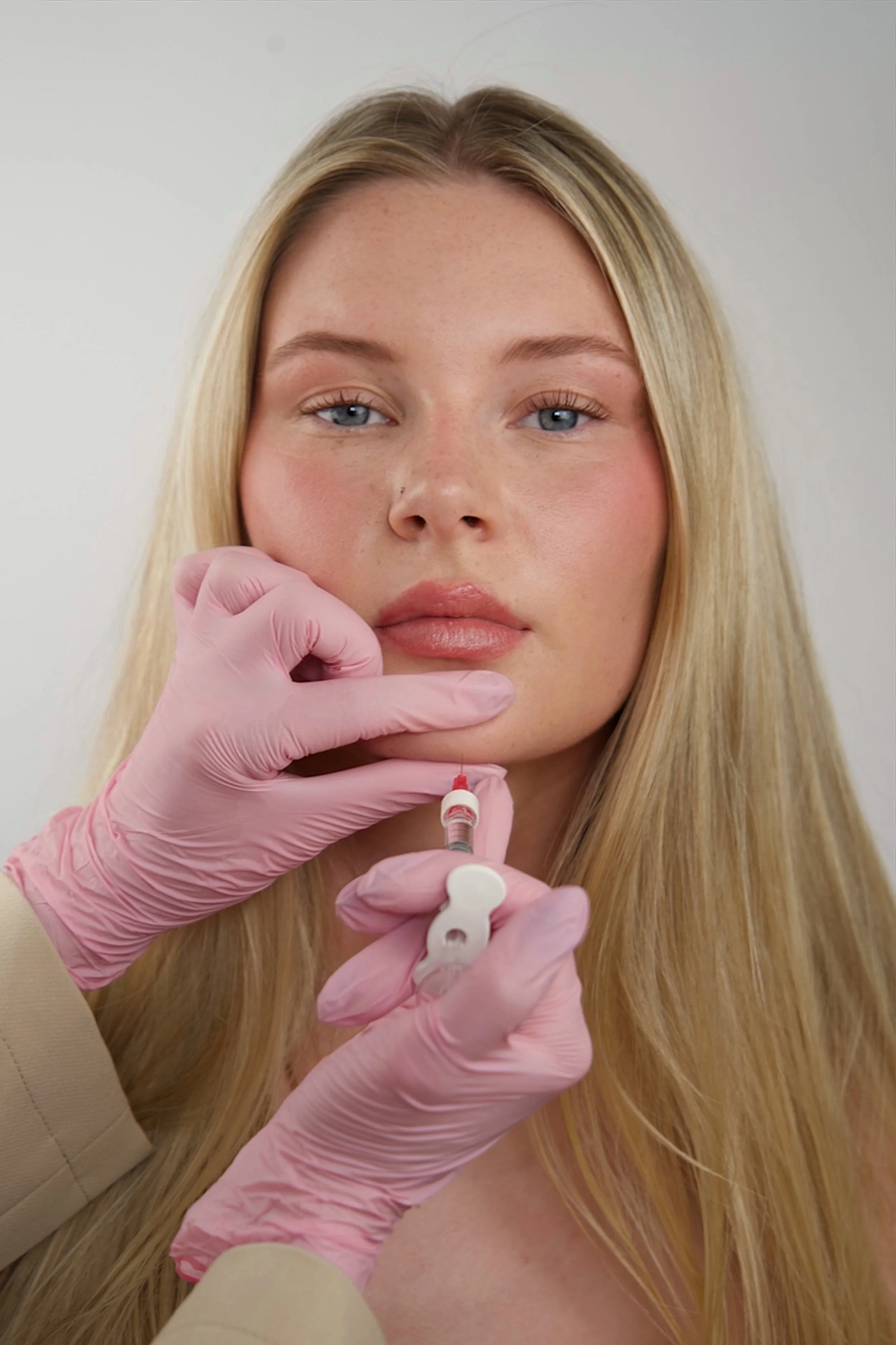 chin shadow horsham with dermal filler