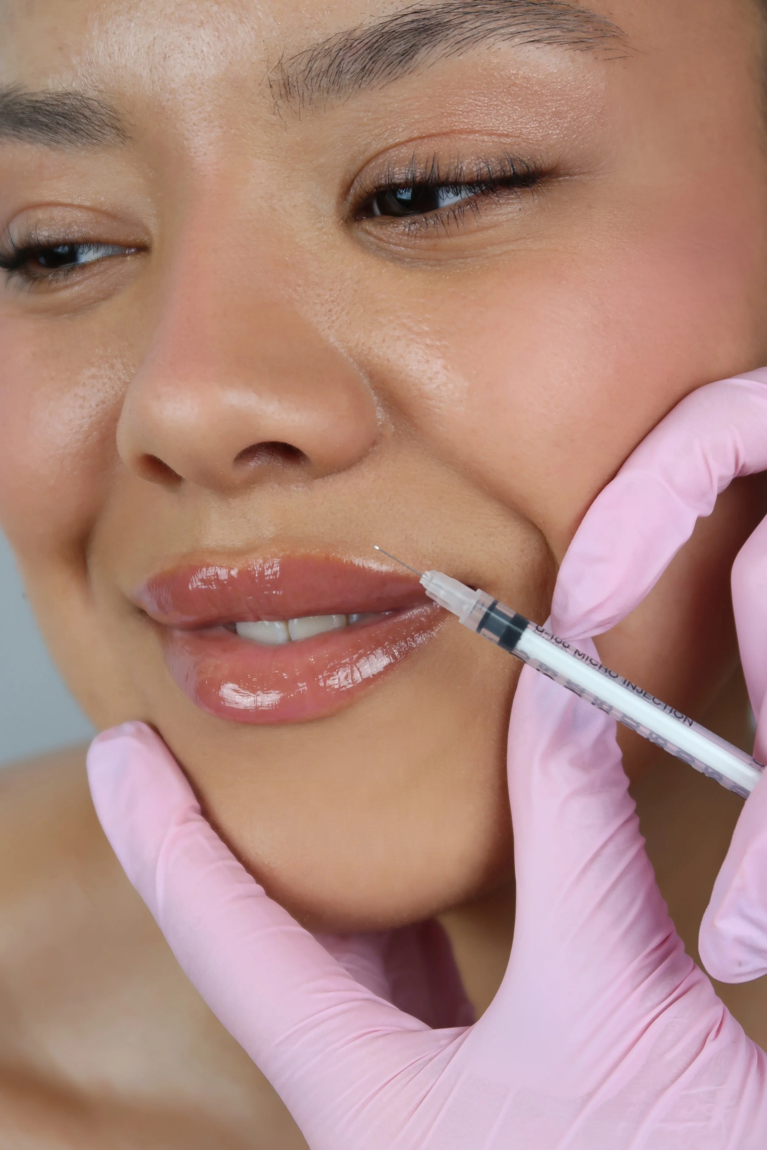 reversing dermal filler horsham West Sussex