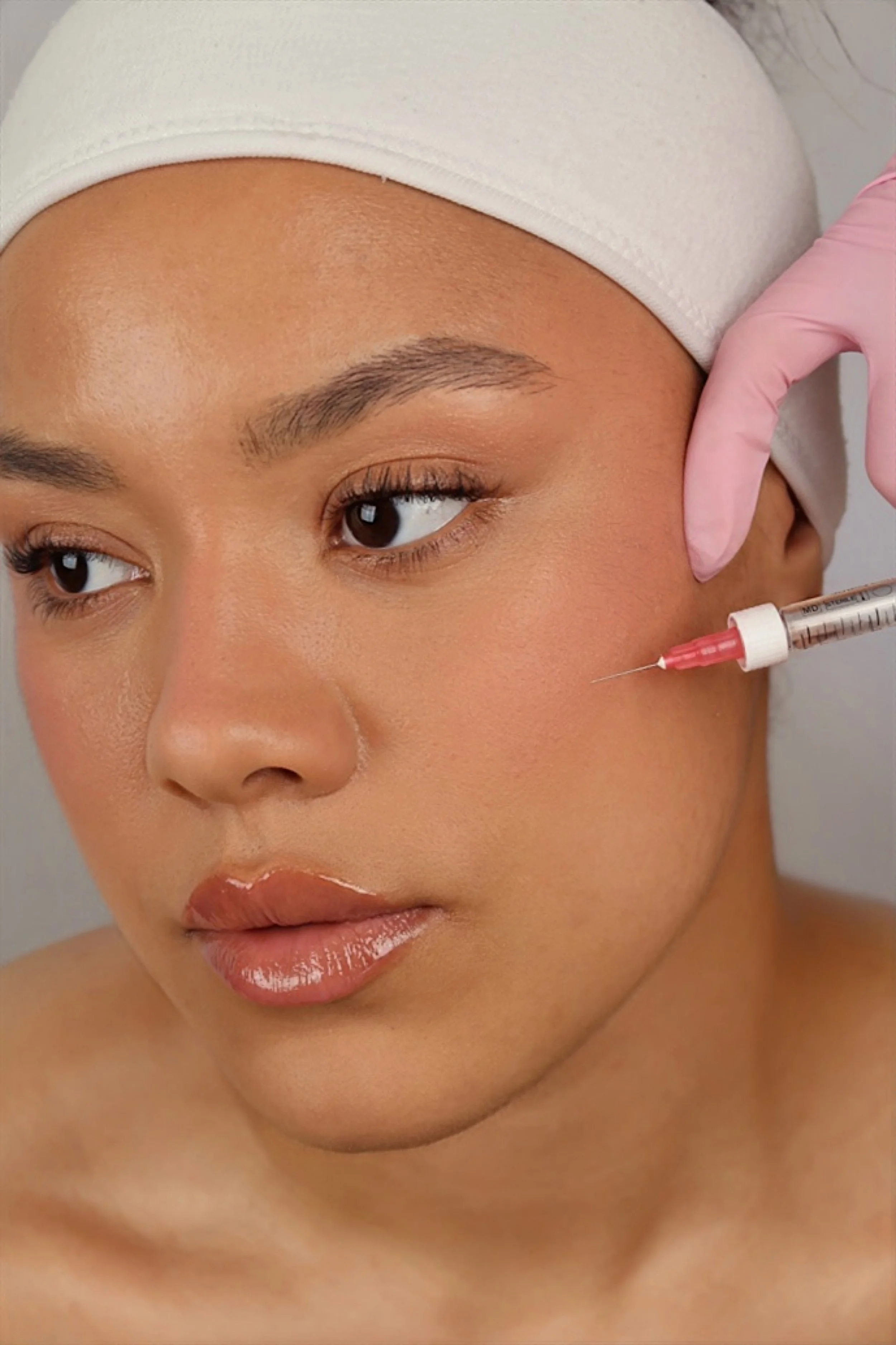 cheek filler west Sussex aesthetics