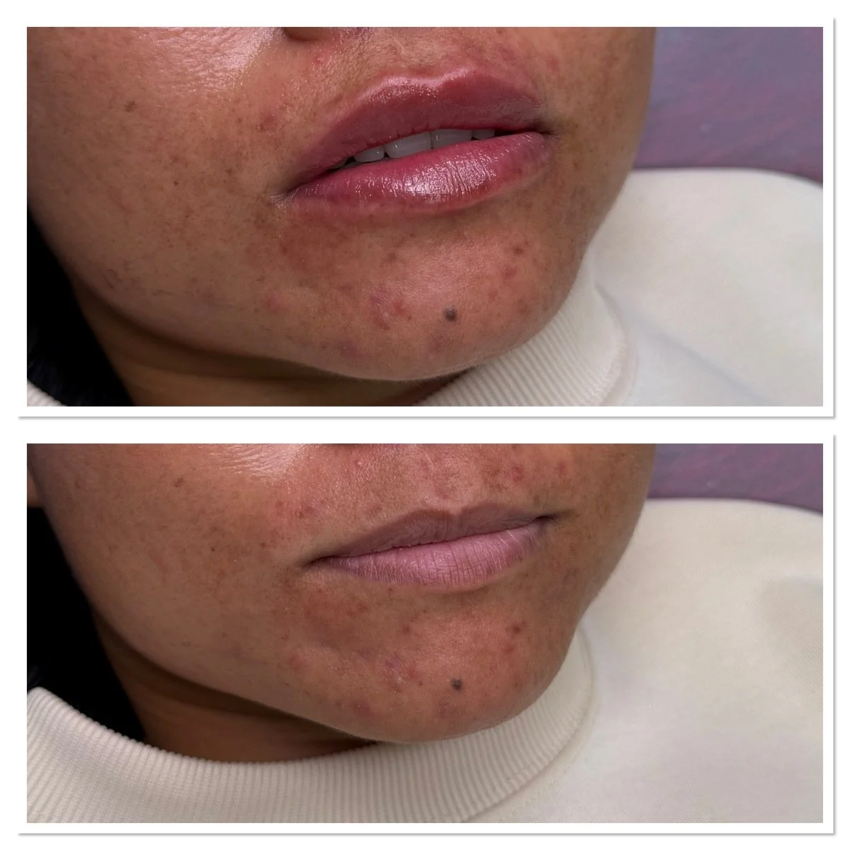 Ennen ja jälkeen kuva2