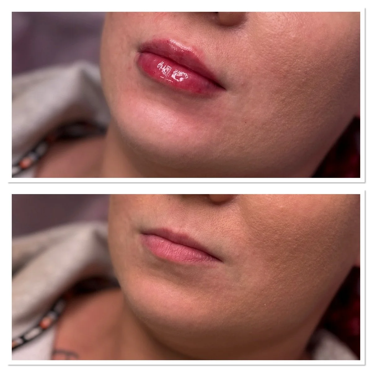 Ennen ja jälkeen kuva4