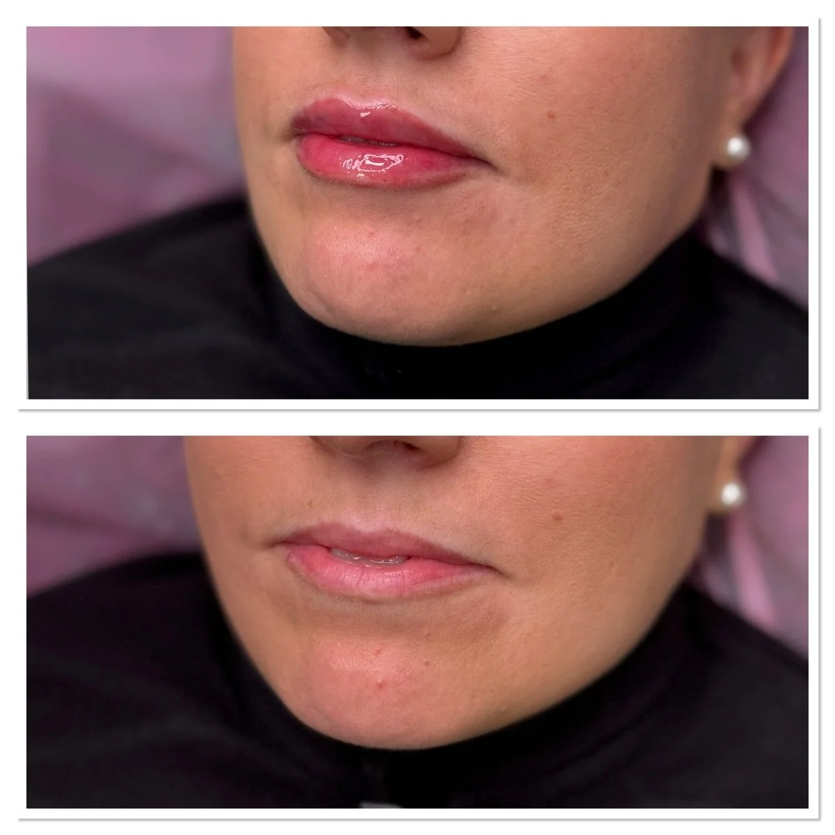 Ennen ja jälkeen kuva3