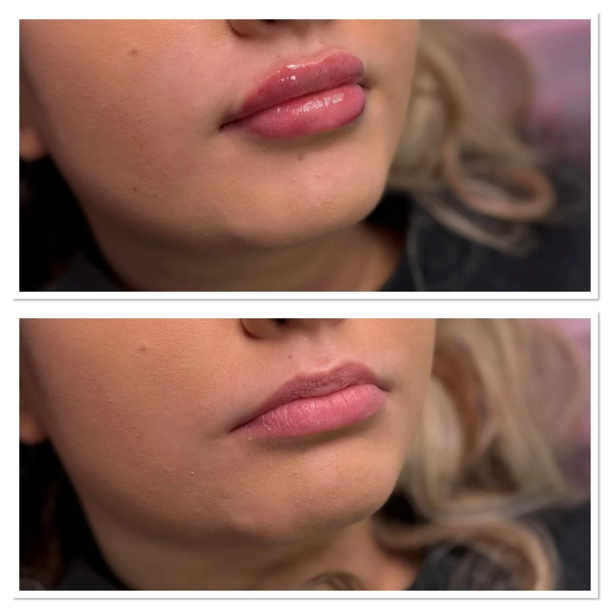 Ennen ja jälkeen kuva5