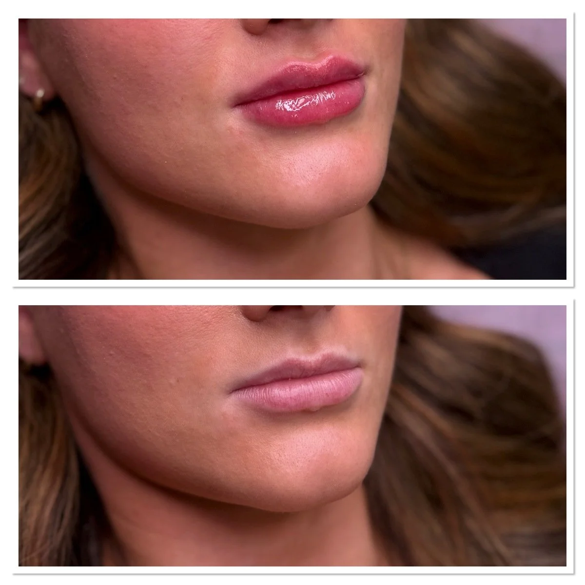 Ennen ja jälkeen kuva6