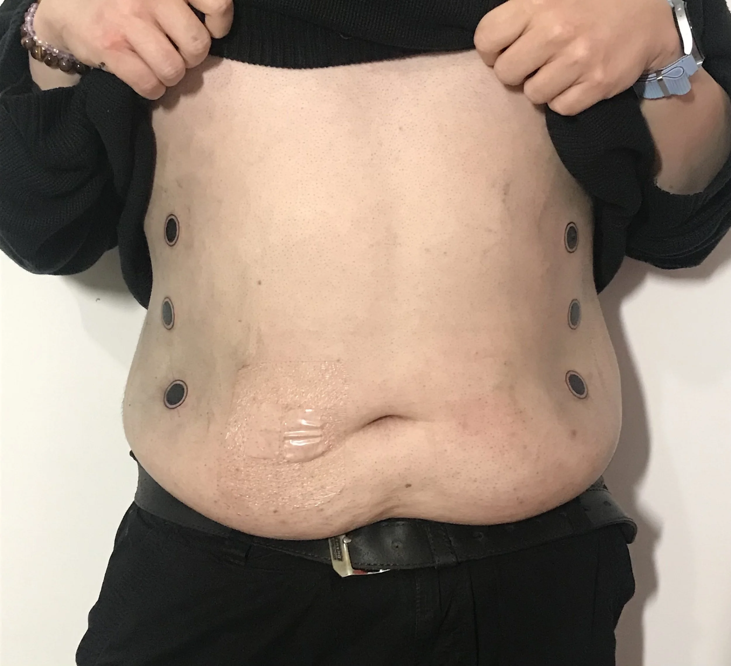 Six concentric circle tattoos along sides of abdomen. 