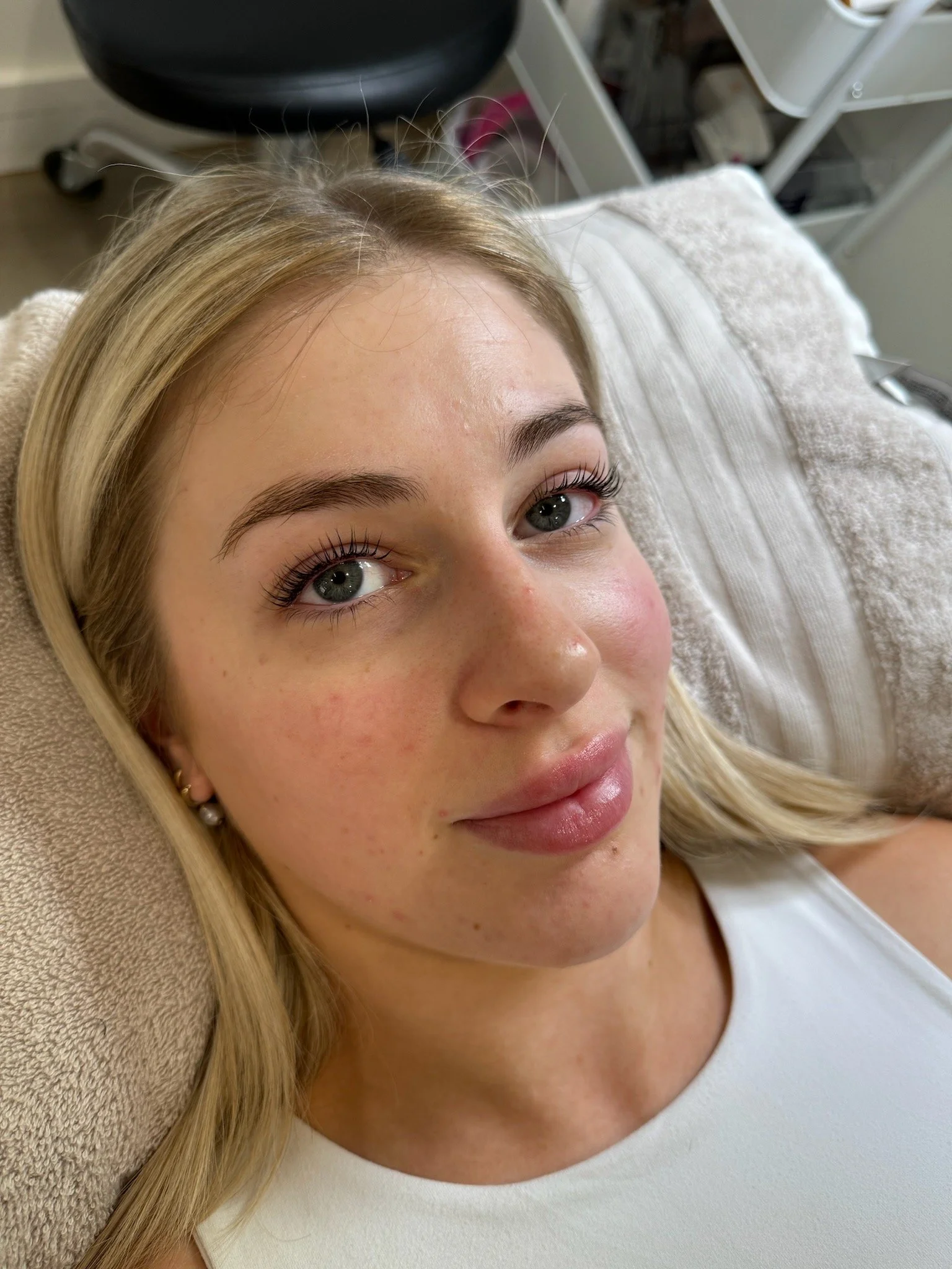 Close-up of a young woman lying on a bed or examination table, with blonde hair and hazel eyes, smiling softly. She is wearing a white top and appears to be relaxed.