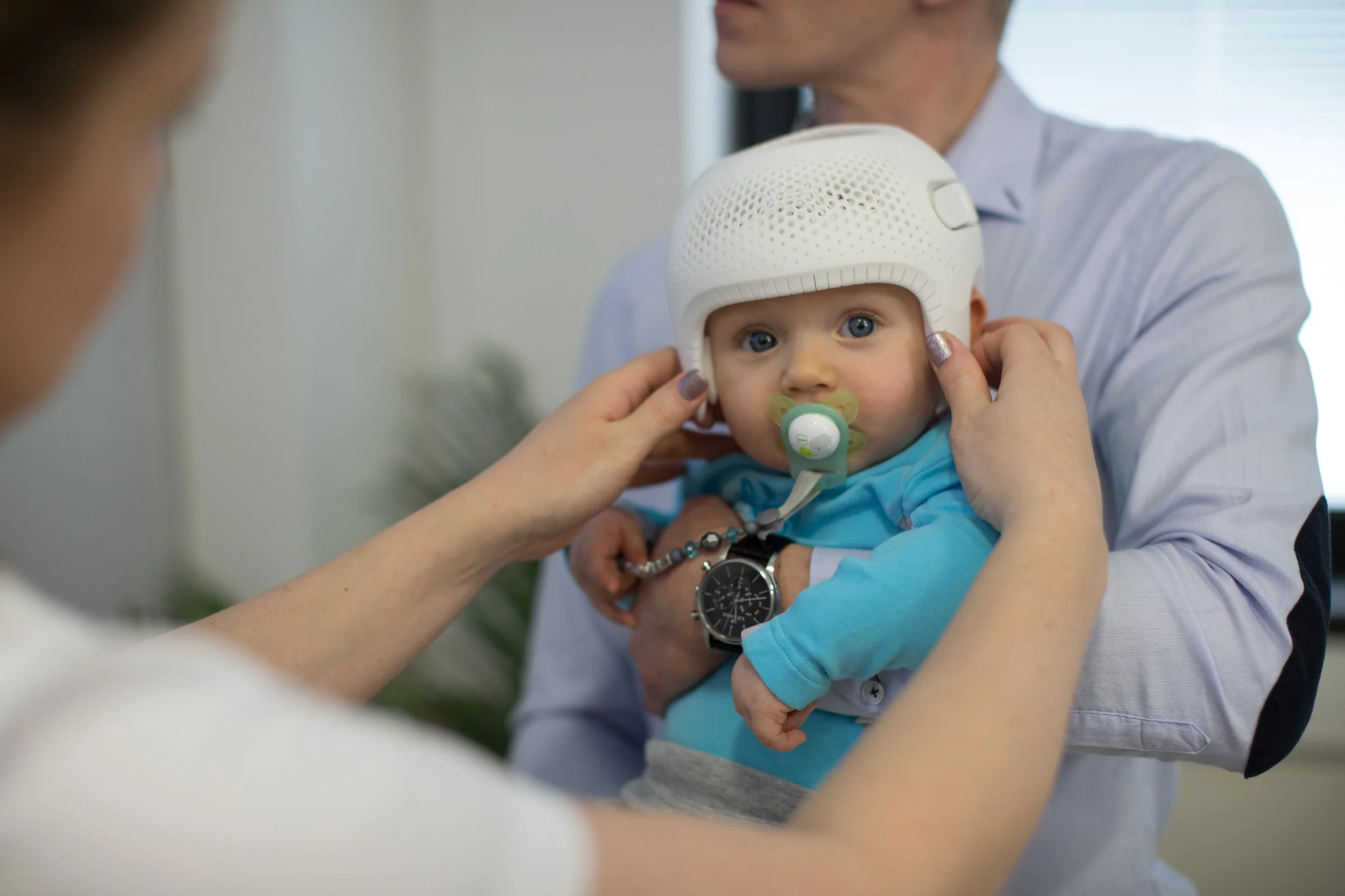 Baby with blue eyes wearing a helmet and pacifier, held by a man in a light blue shirt, being examined by a nurse or doctor.