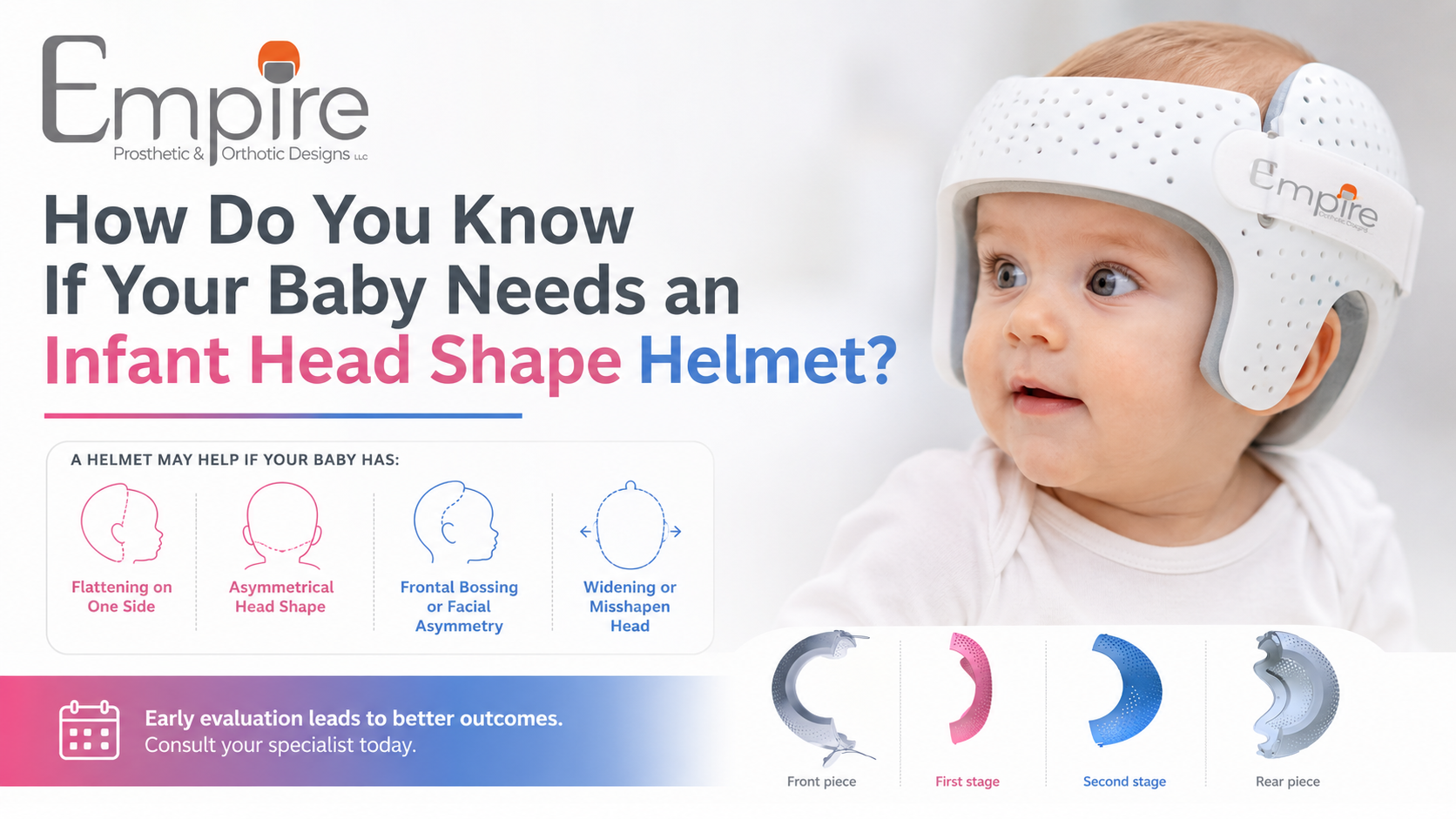 Infant Head Shape Helmet Guide