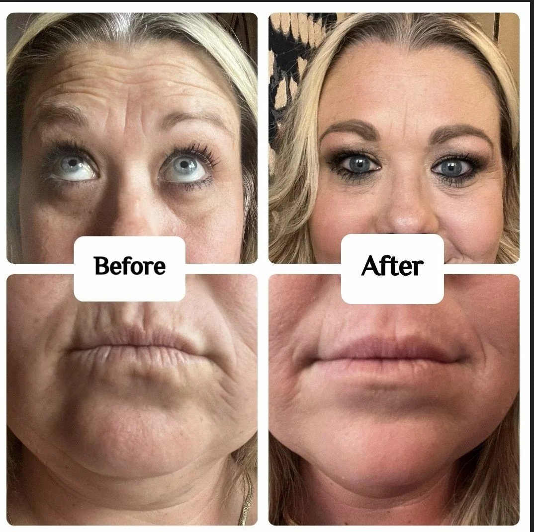 Comparison of woman's face before and after cosmetic treatment; top images show her eyes and lips, with the 'before' image on the left appearing more aged and the 'after' image on the right showing smoother skin and enhanced makeup.
